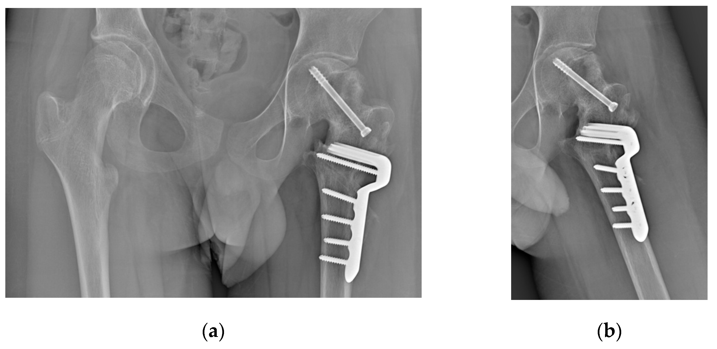 Preprints 141437 g010