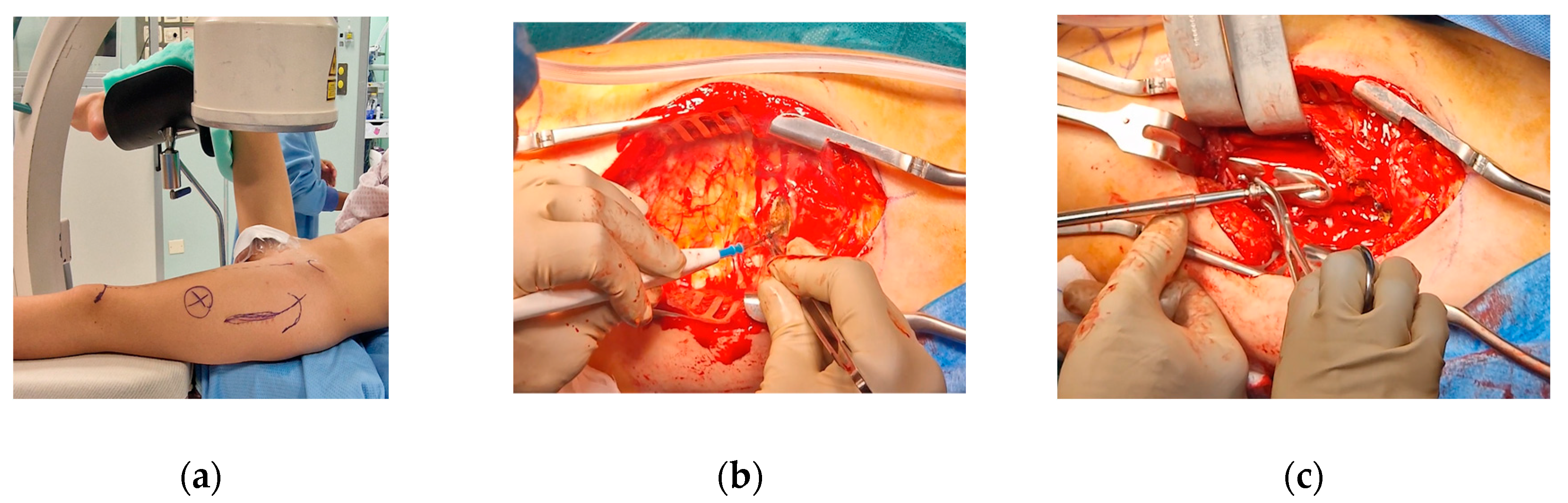 Preprints 141437 g018