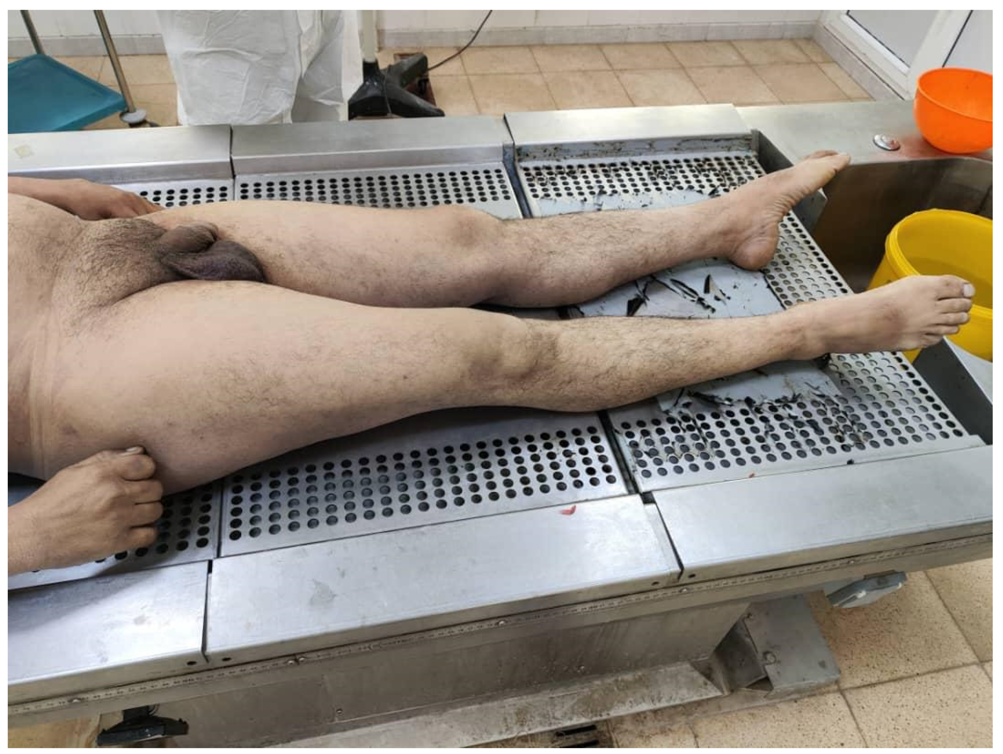 Preprints 174682 g001