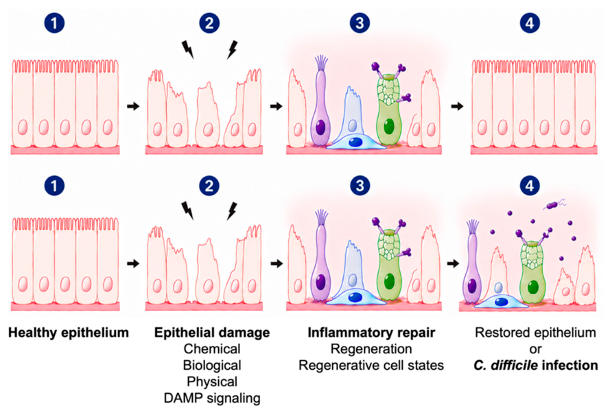 A New Hypothesis for Clostridioides difficile Infection Vulnerability ...
