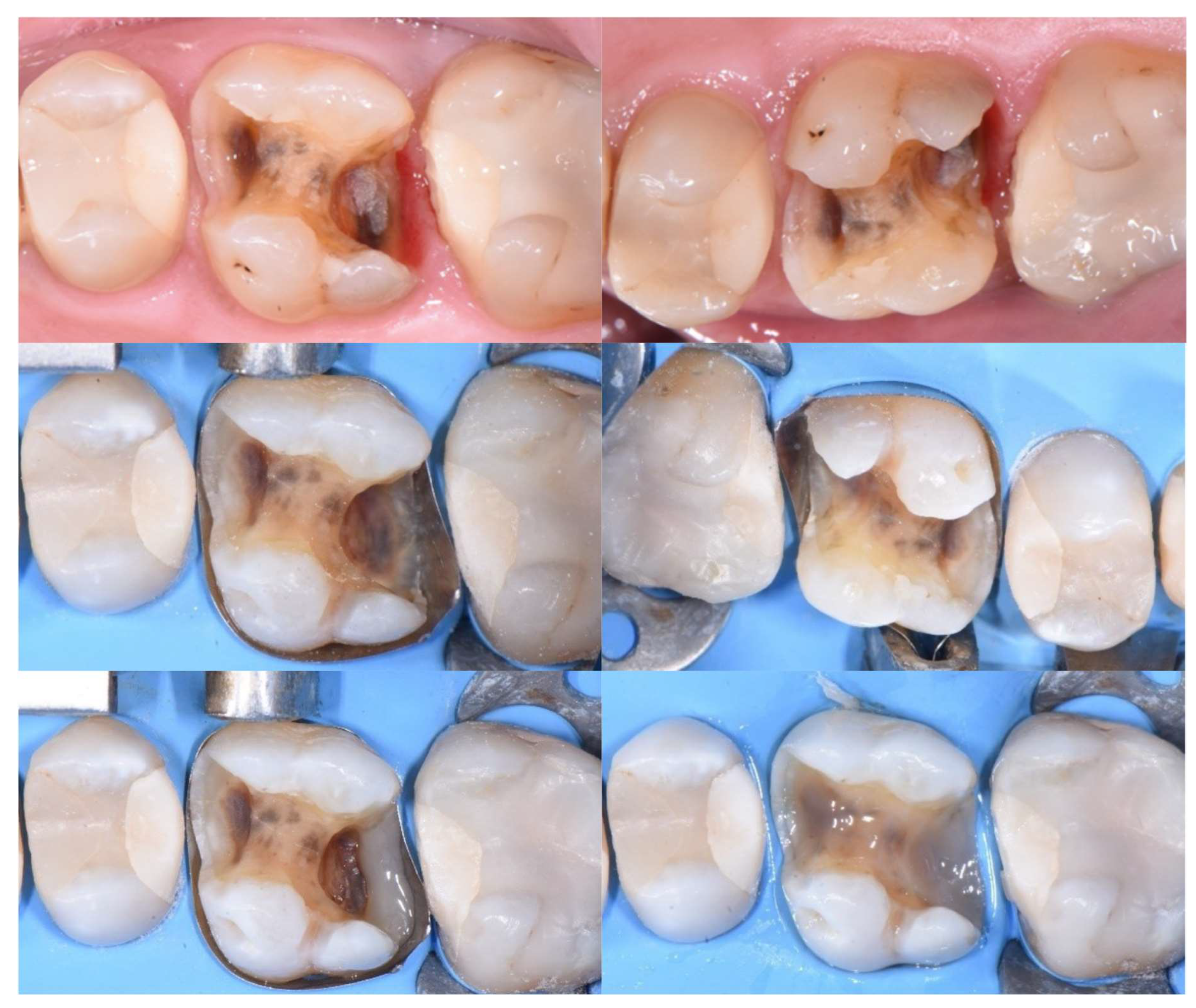 Preprints 158945 g004