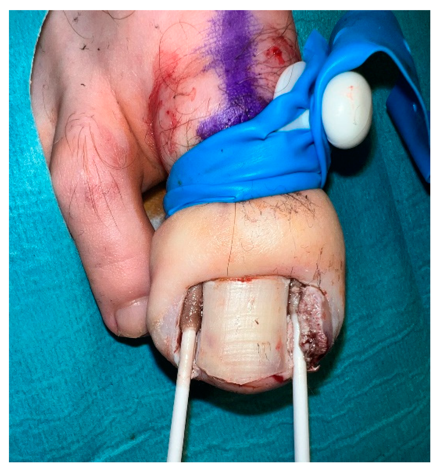 Preprints 72292 g003