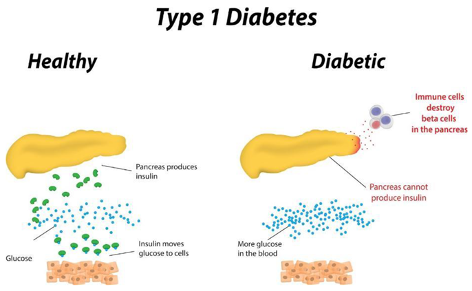 Preprints 163805 i001