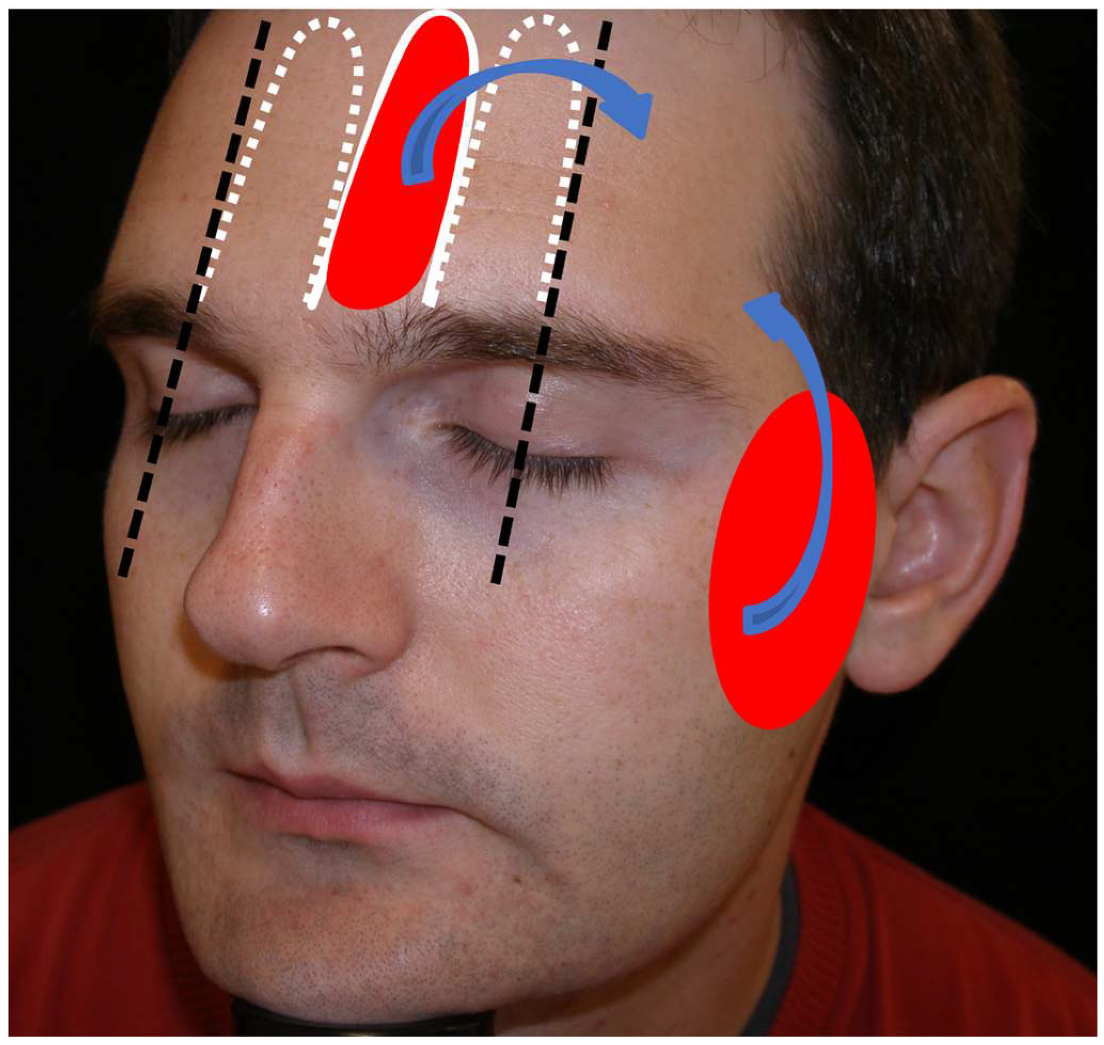 Preprints 81687 g001