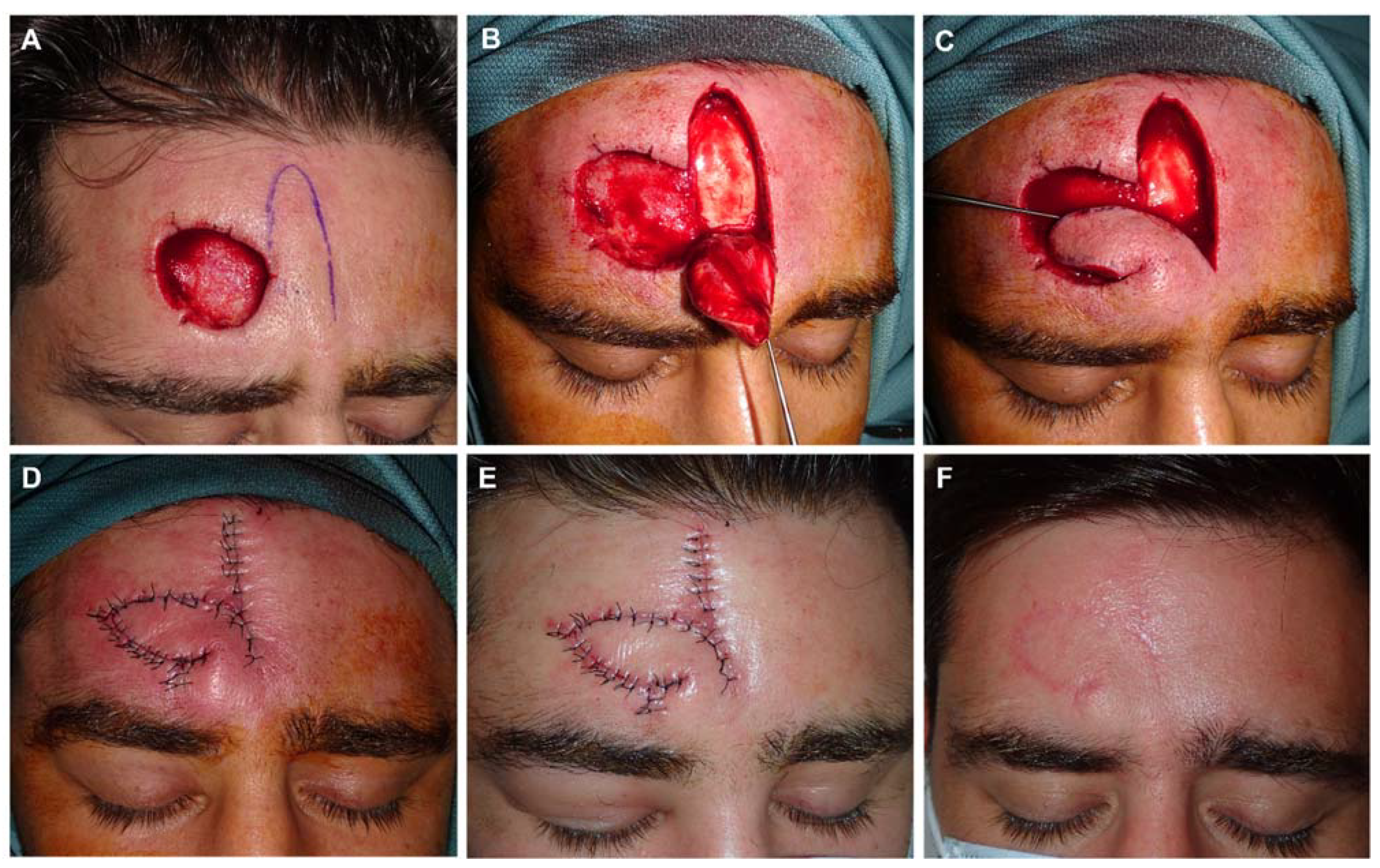 Preprints 81687 g002