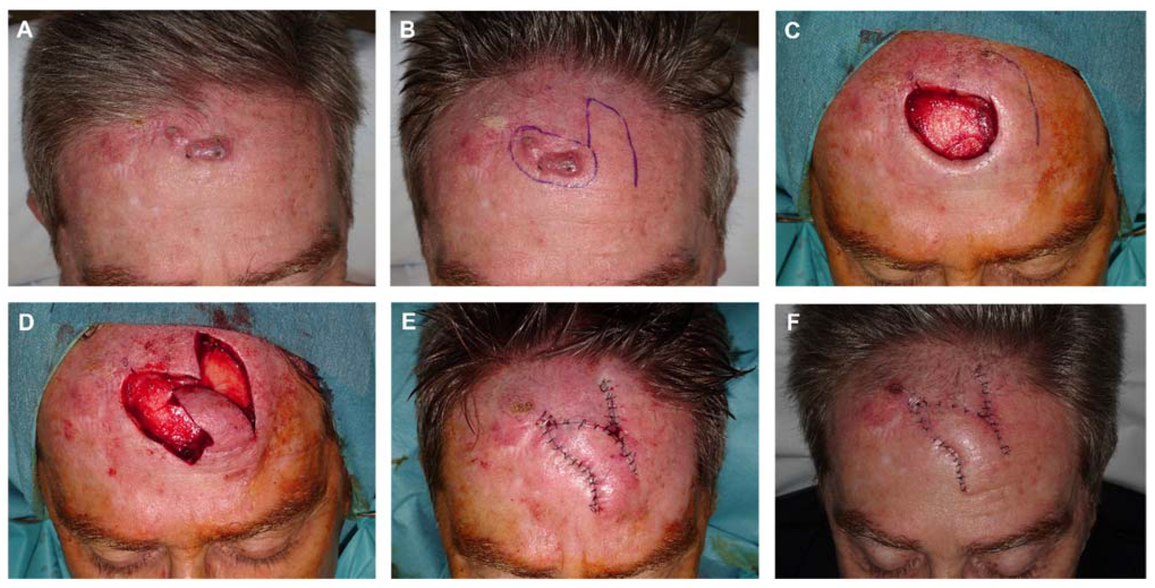 Preprints 81687 g003