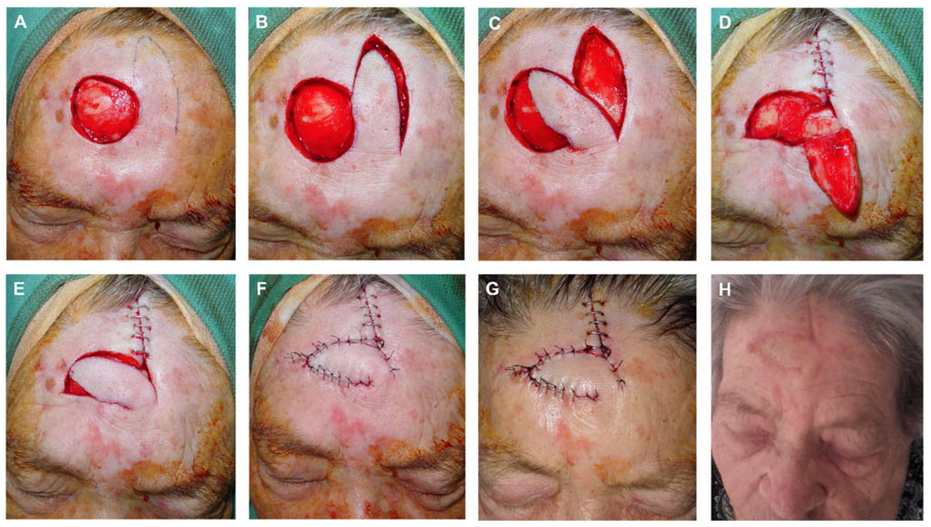 Preprints 81687 g004
