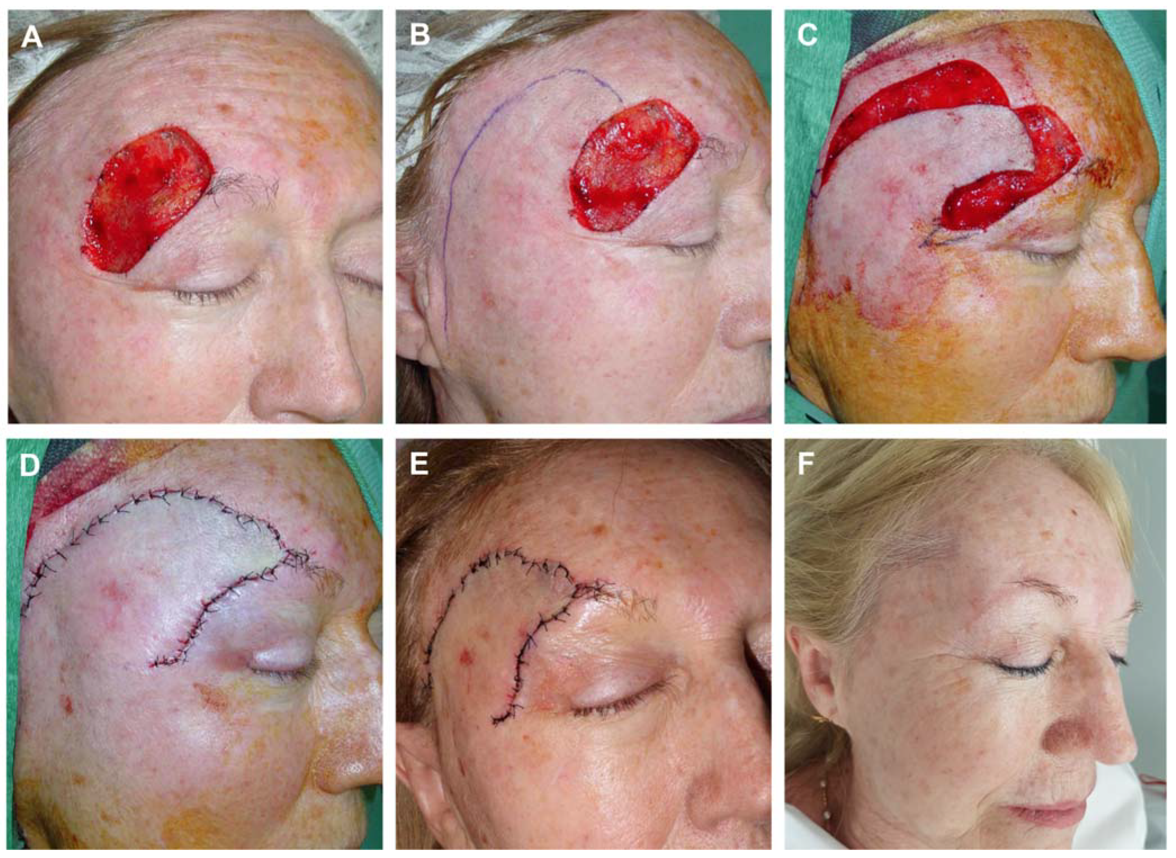 Preprints 81687 g005