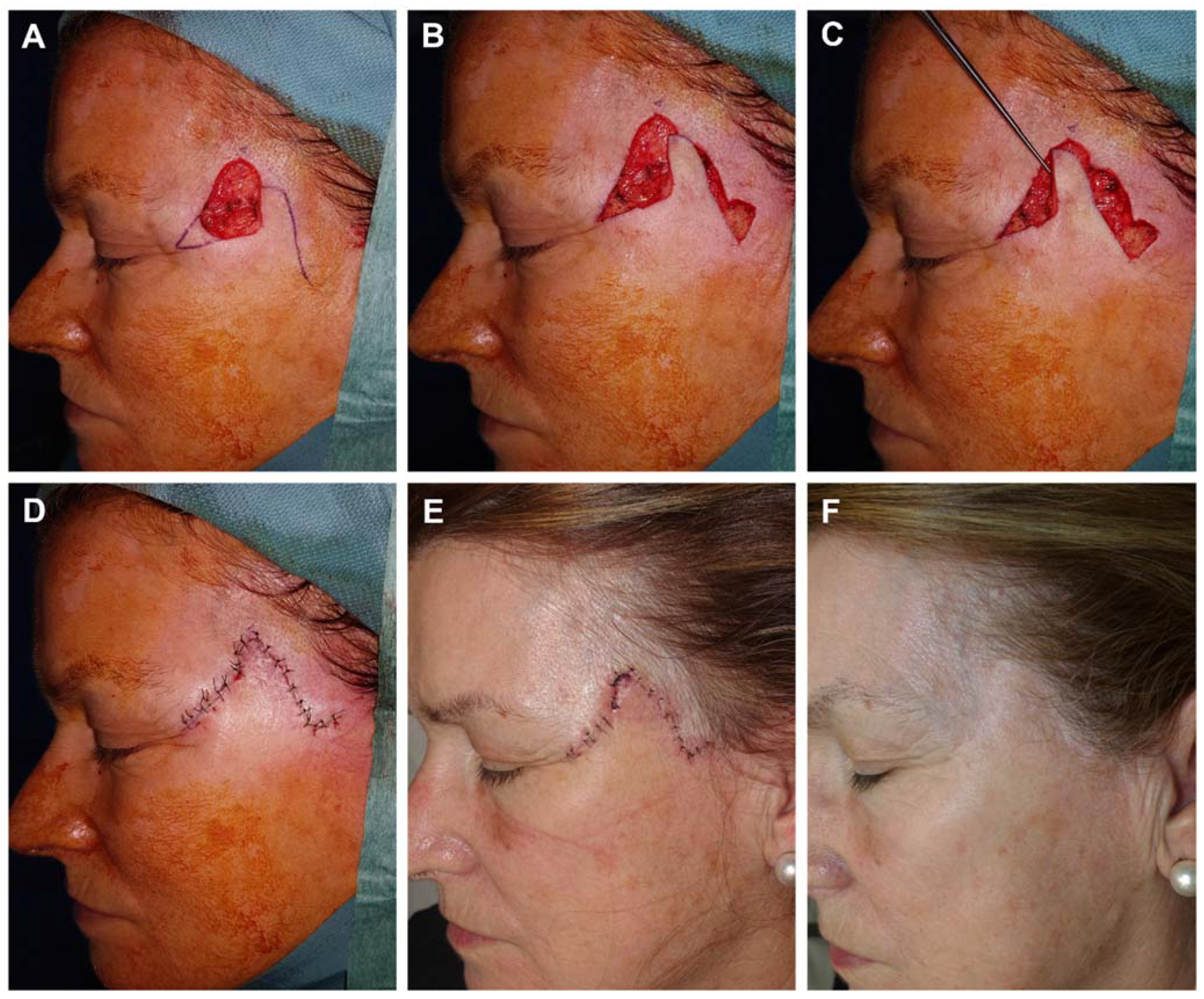 Preprints 81687 g006