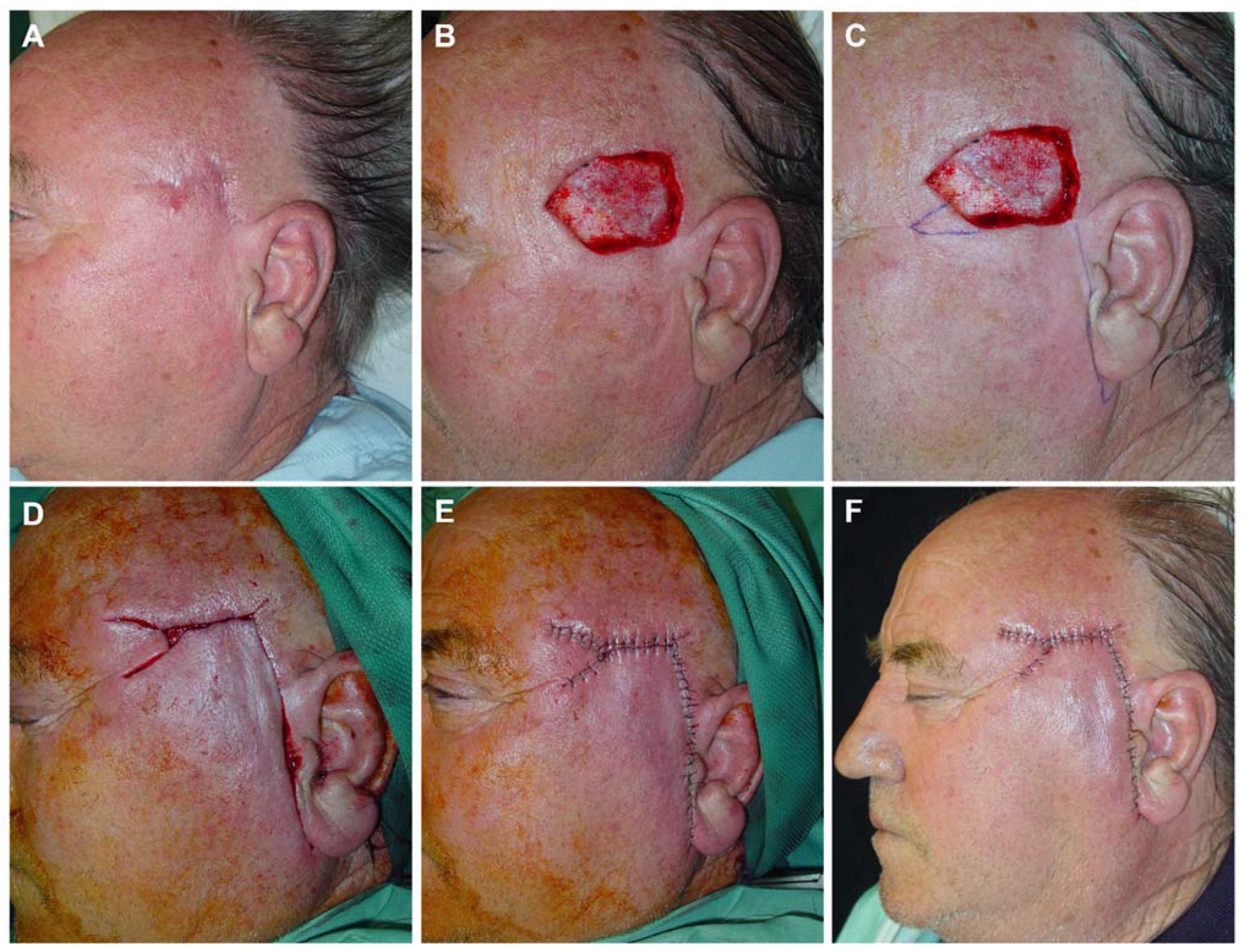 Preprints 81687 g007