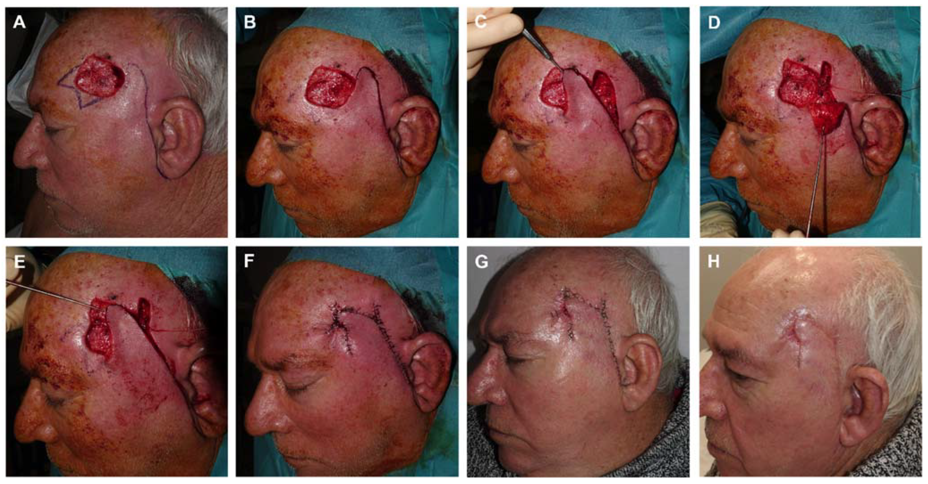 Preprints 81687 g009