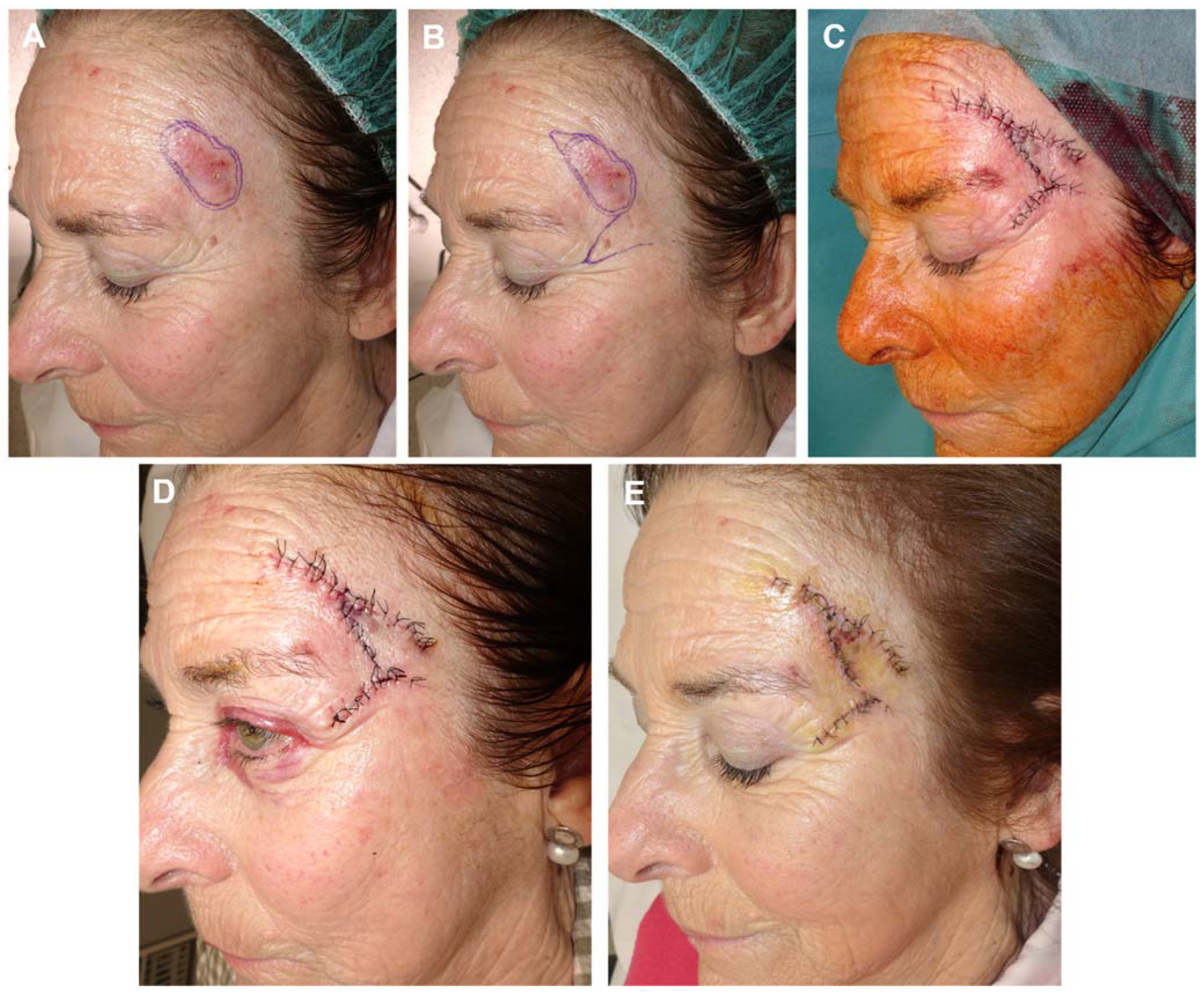 Preprints 81687 g010