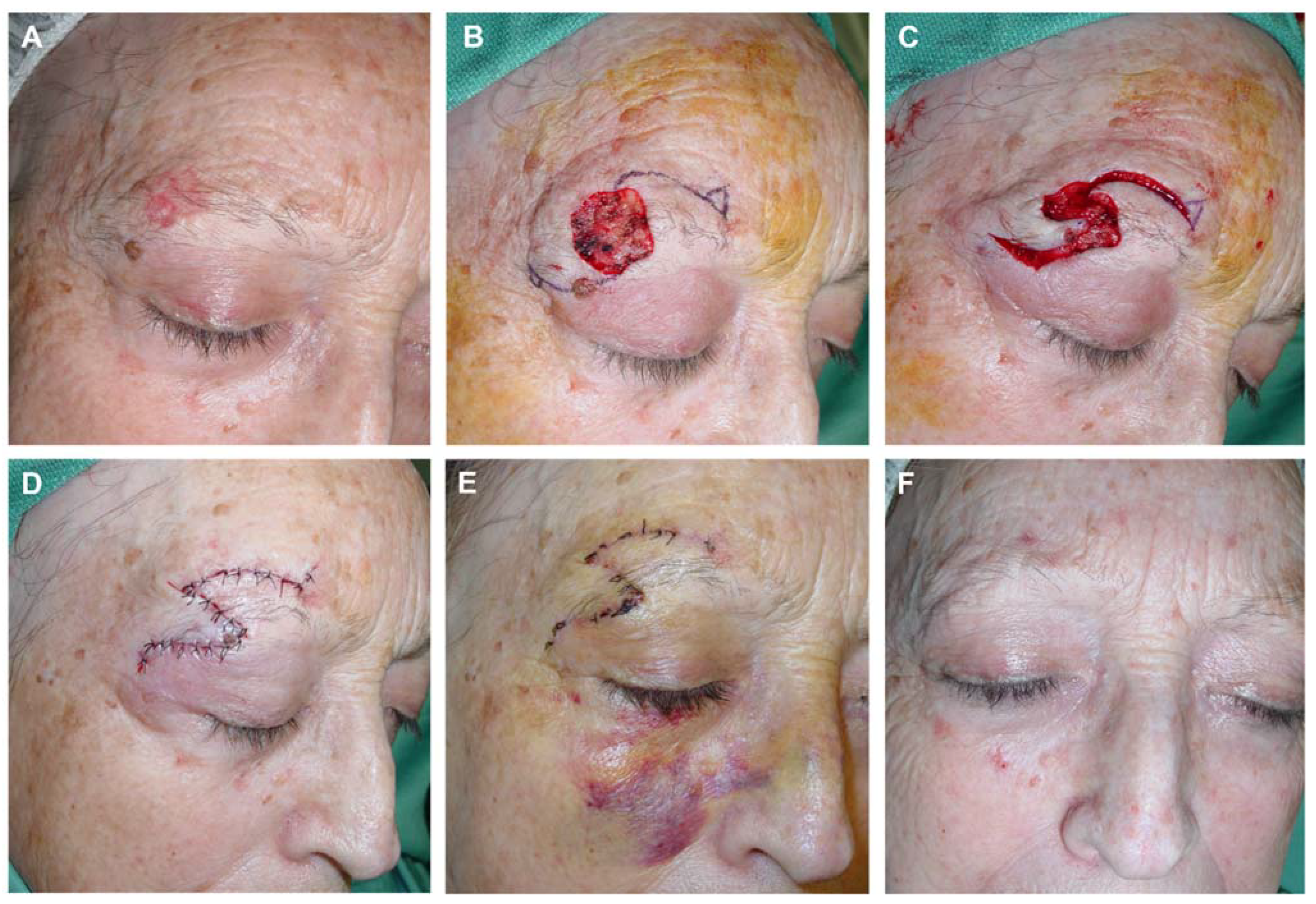 Preprints 81687 g011