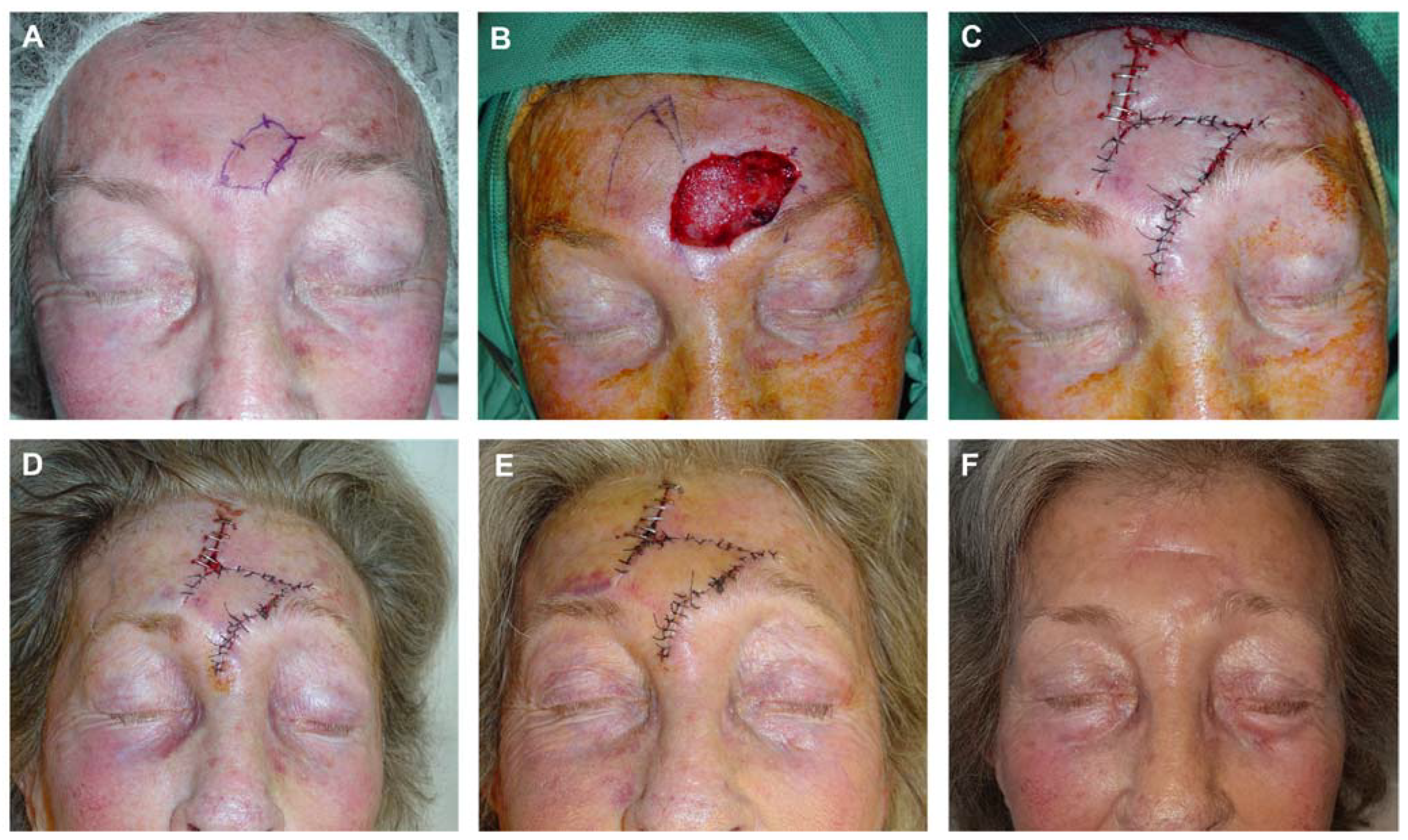 Preprints 81687 g012