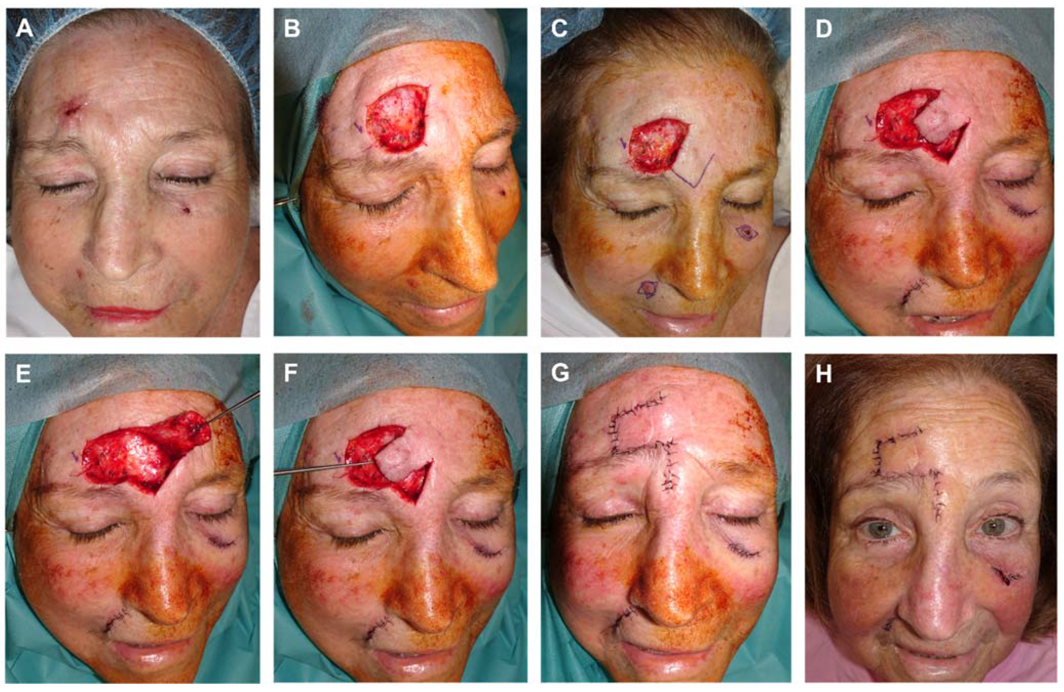 Preprints 81687 g013