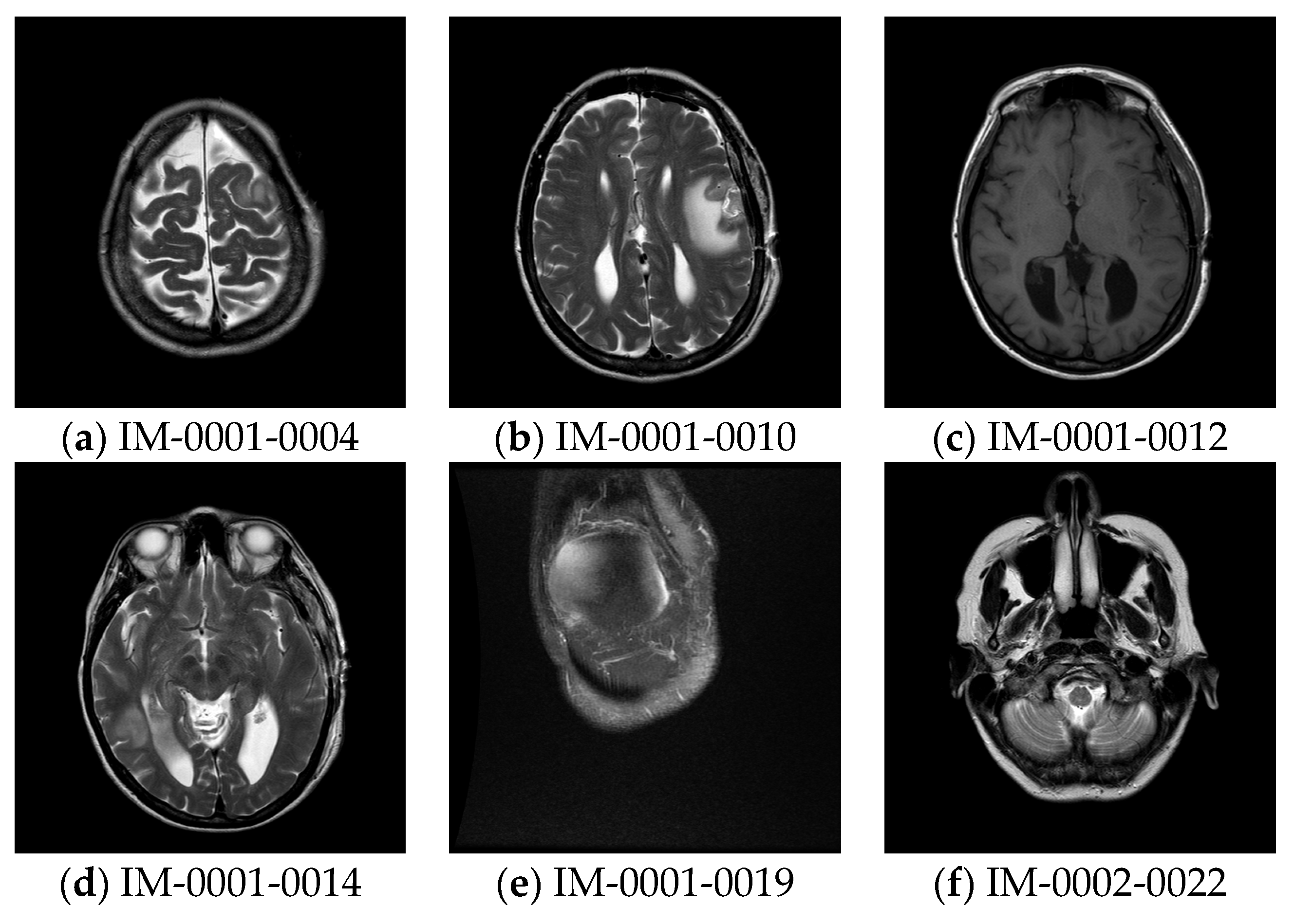 Preprints 80000 g005