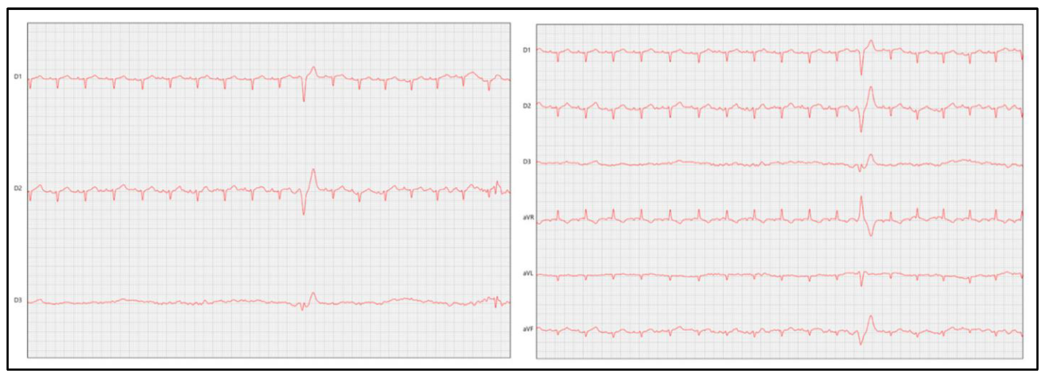 Preprints 148692 g004