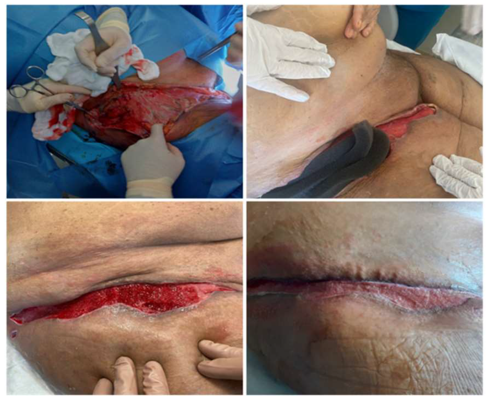 Preprints 148914 g001