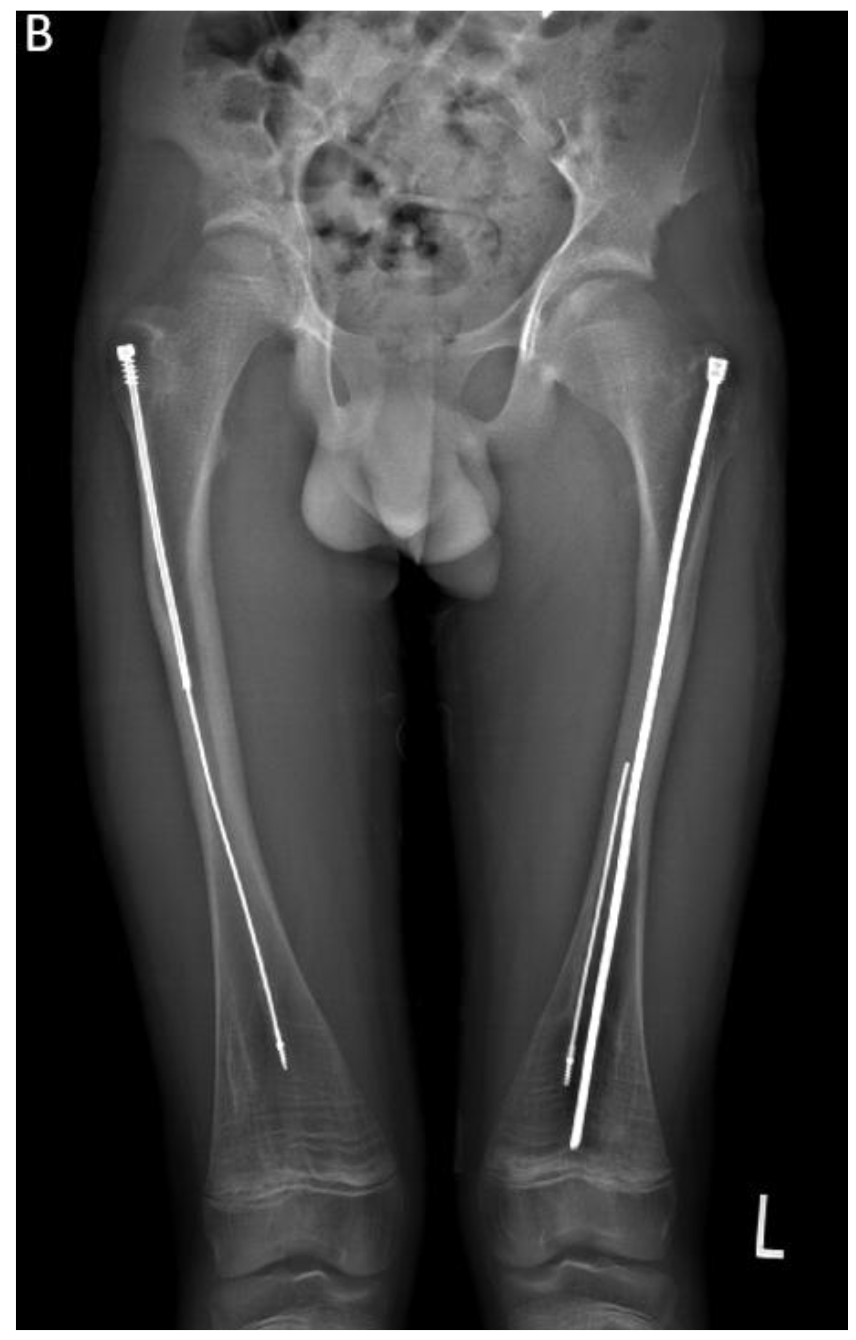 Preprints 171625 g010b