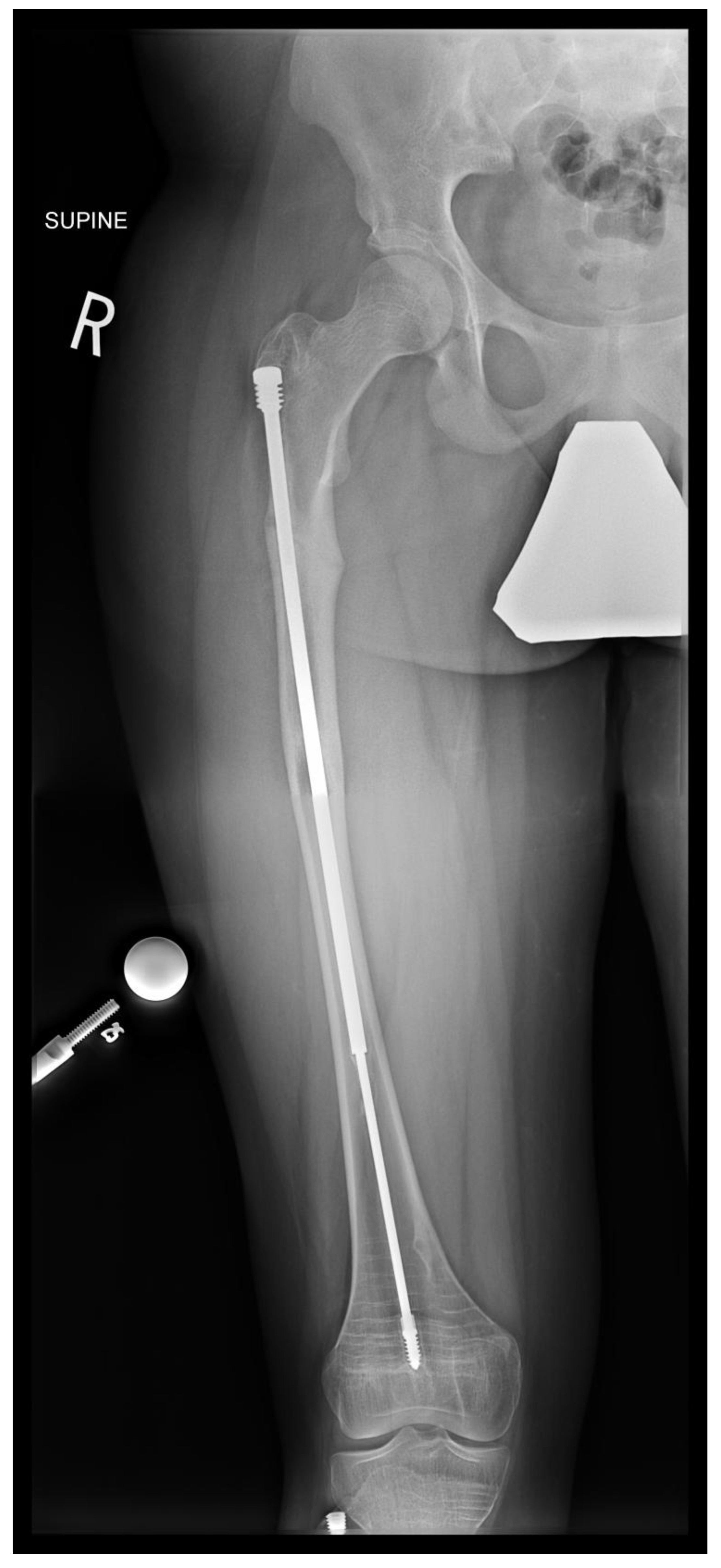 Preprints 171625 g011