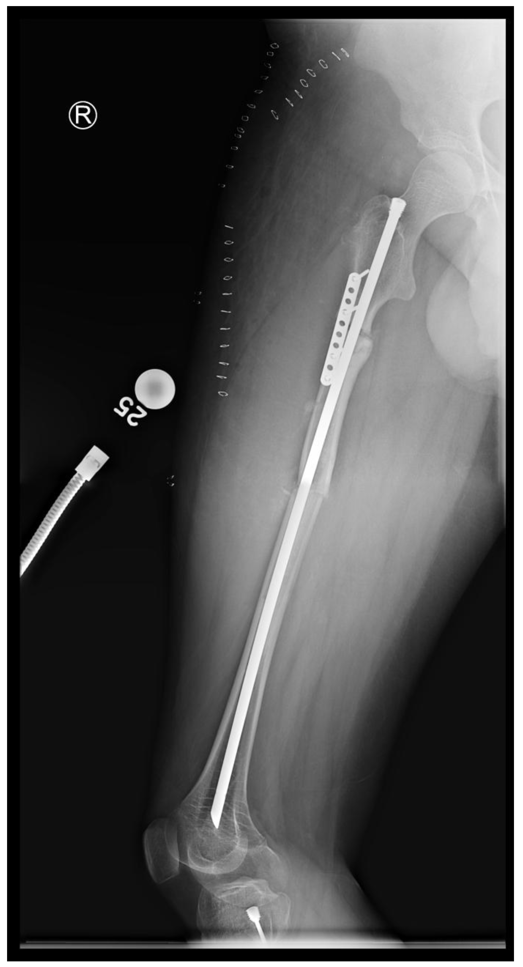 Preprints 171625 g014