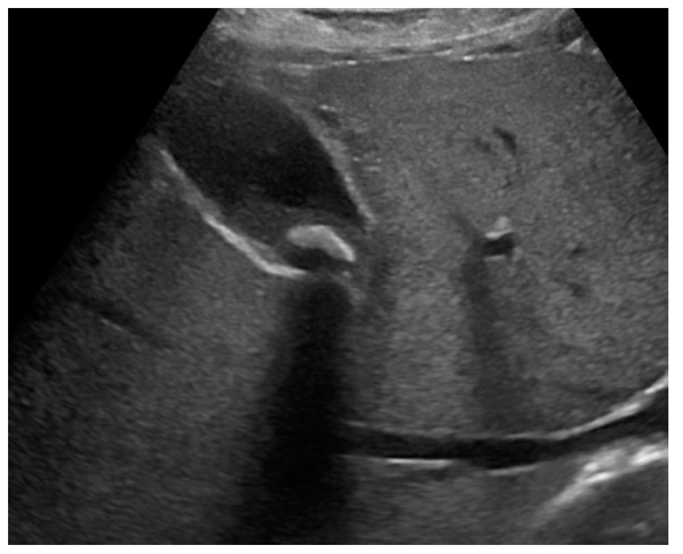 Preprints 91214 g001