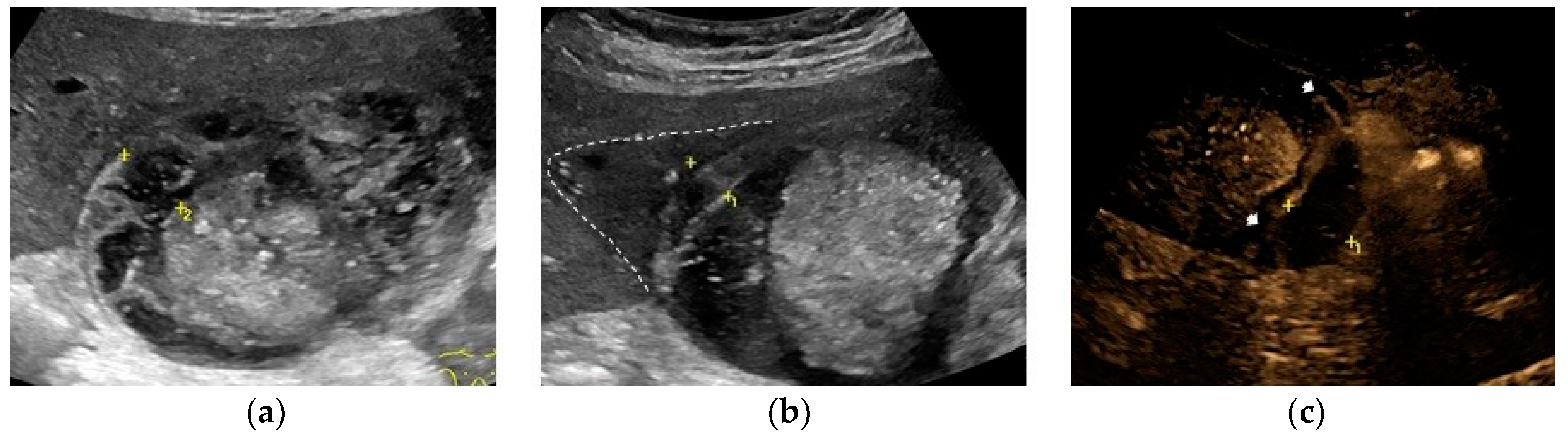Preprints 91214 g002
