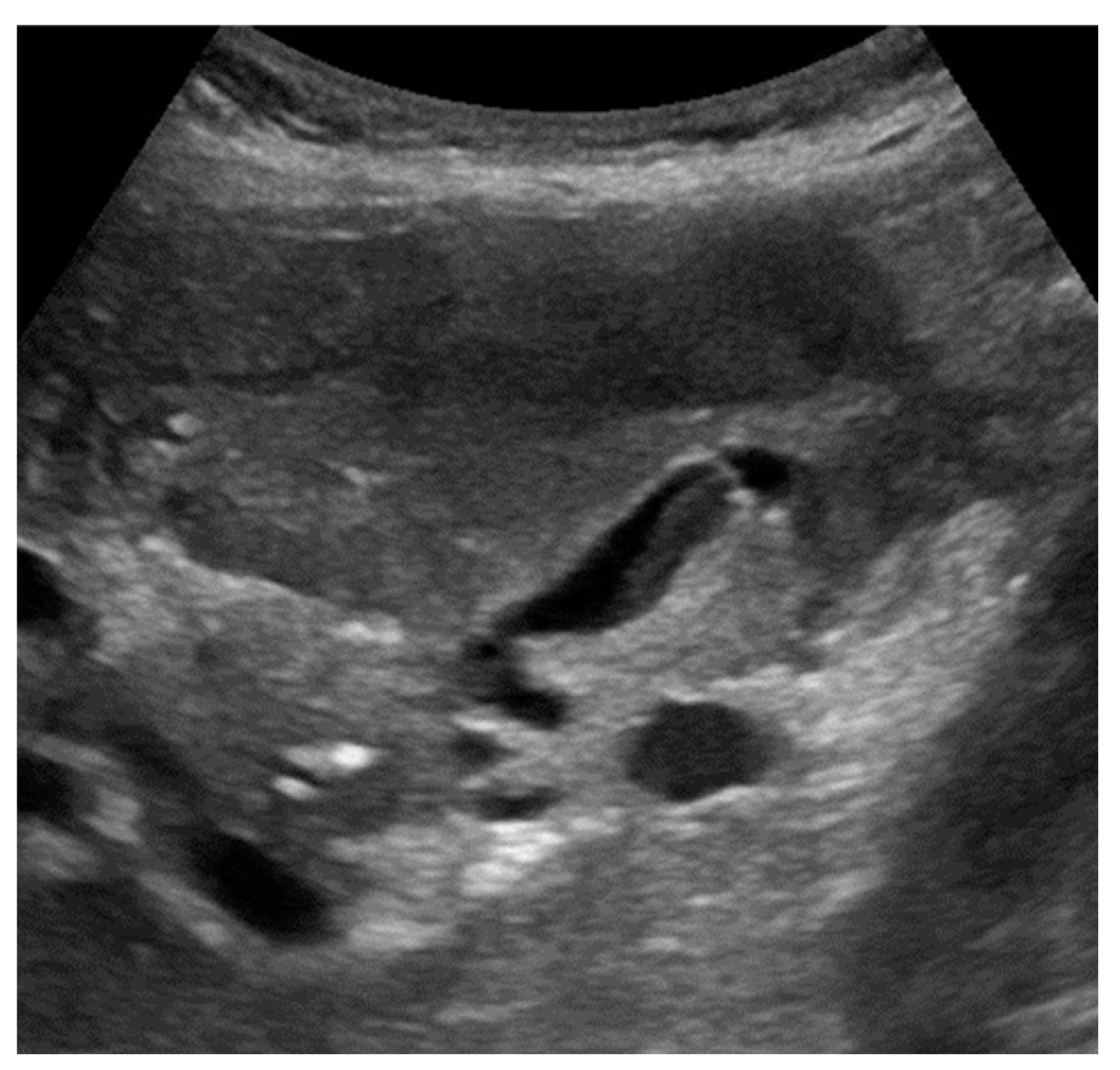 Preprints 91214 g006