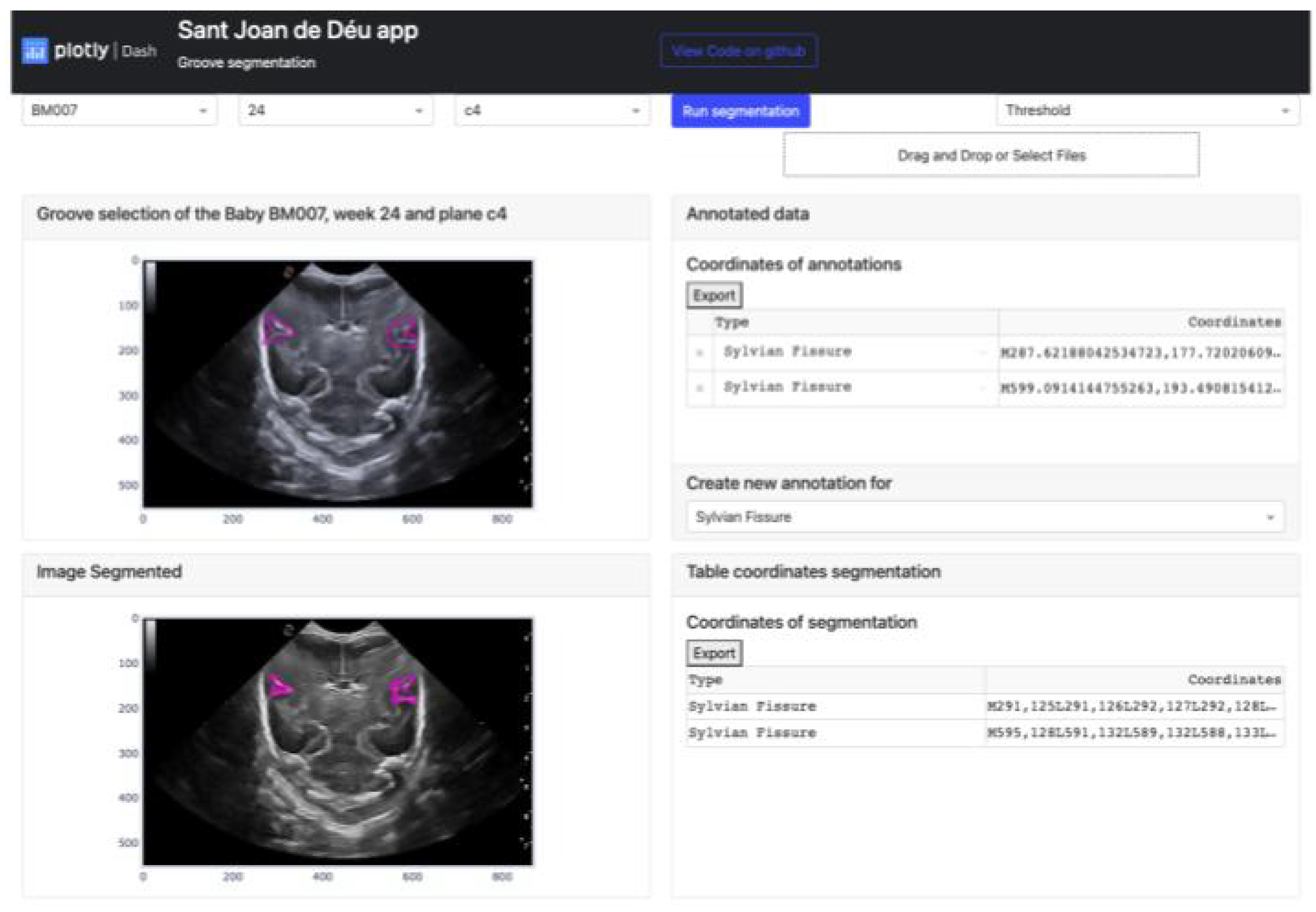 Preprints 73270 g012