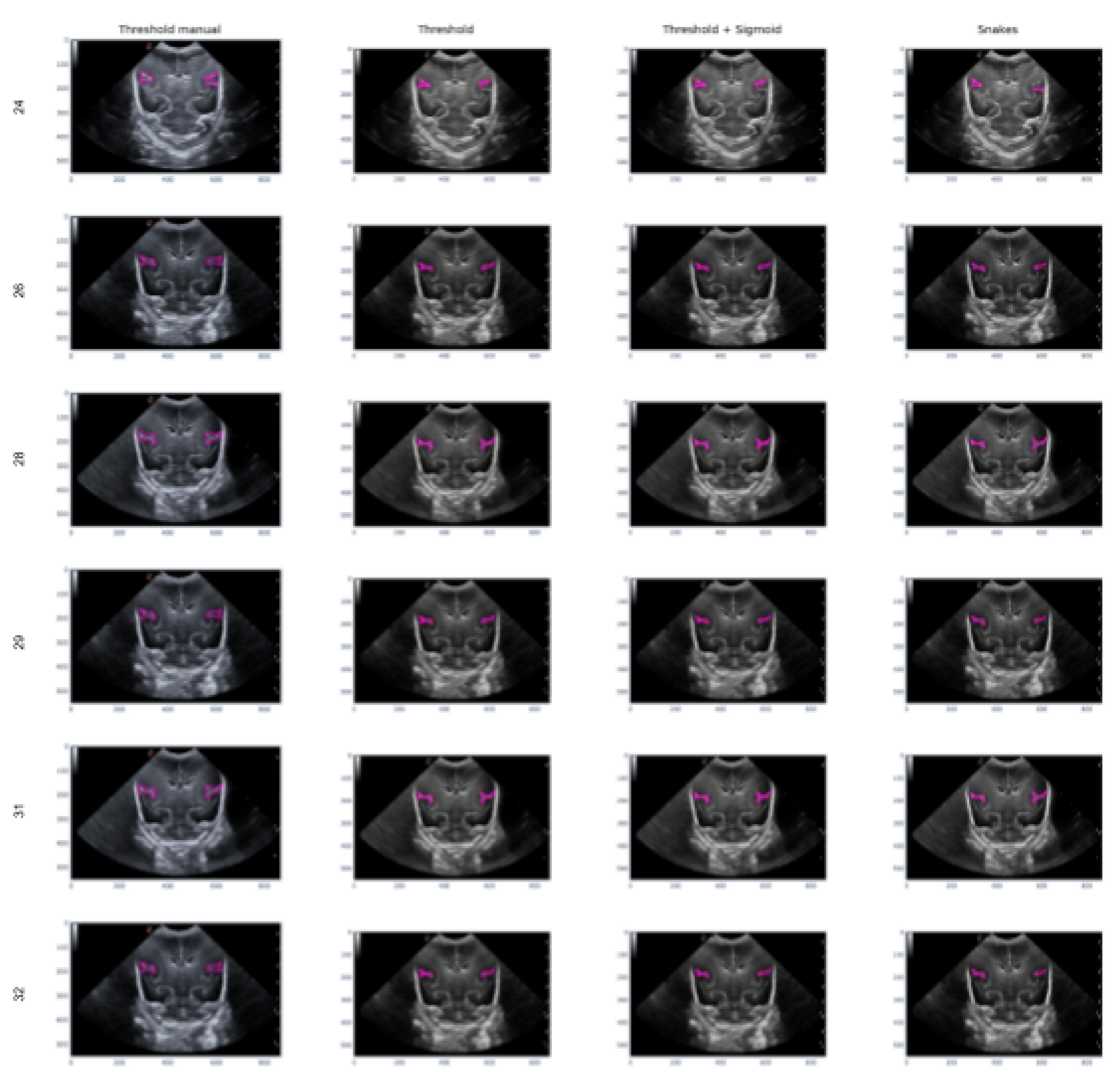 Preprints 73270 g015