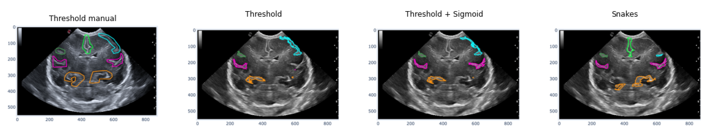 Preprints 73270 g016
