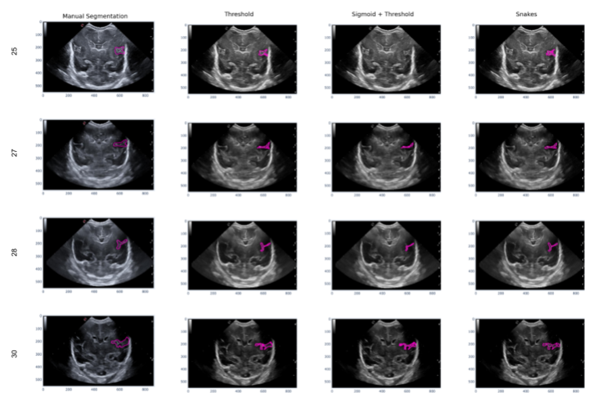 Preprints 73270 g017