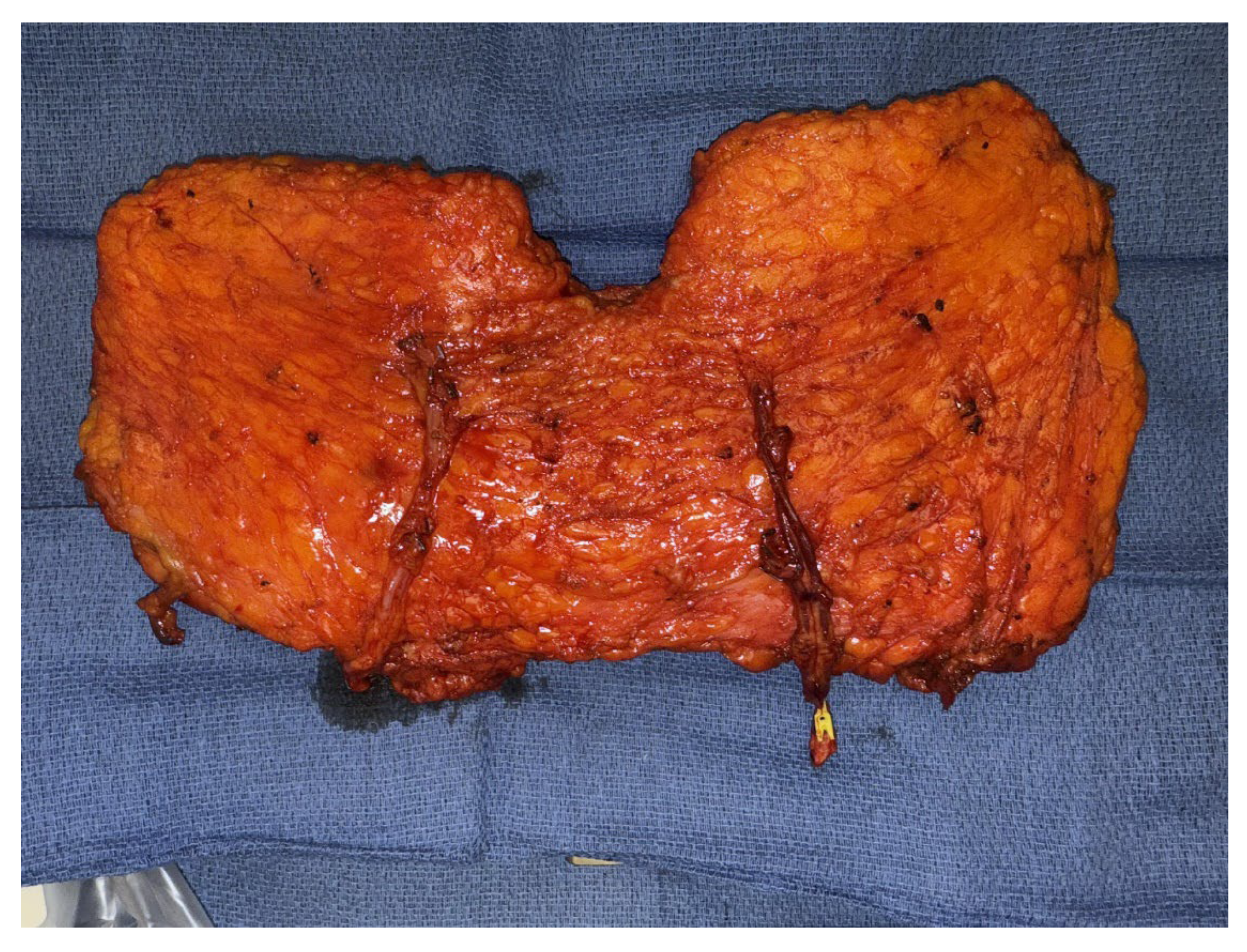 Preprints 170323 g001