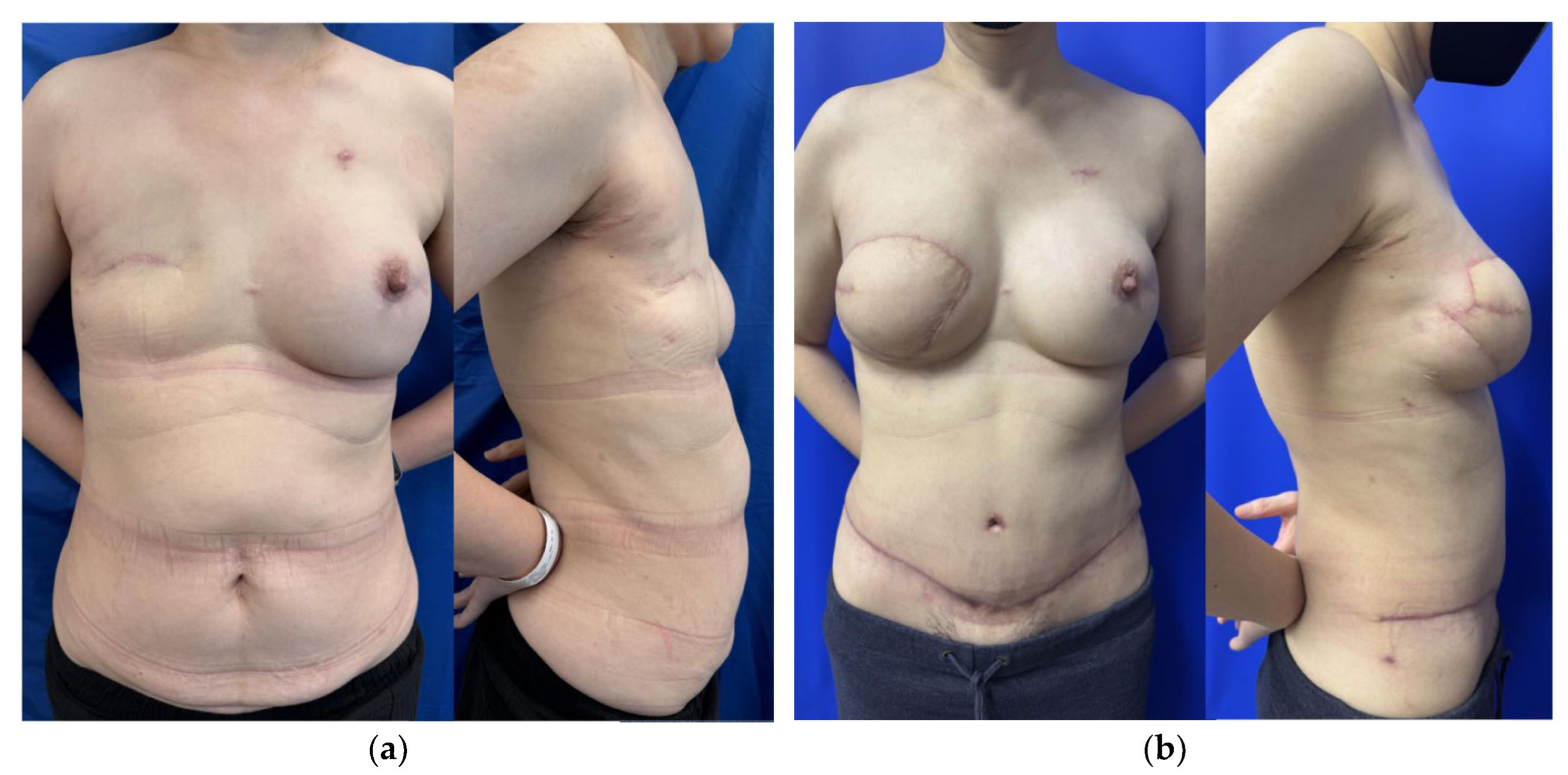 Preprints 170323 g002