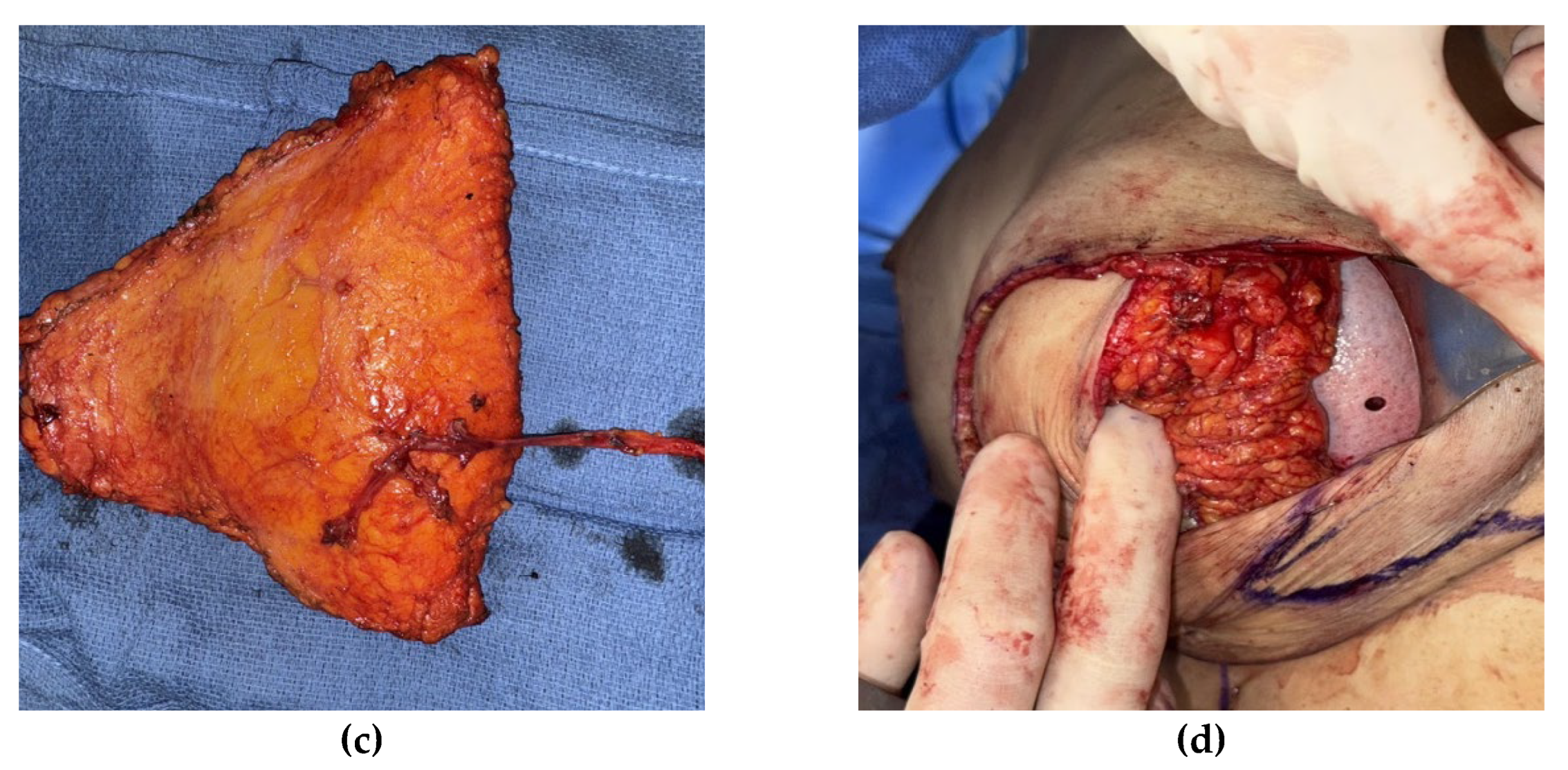 Preprints 170323 g003b