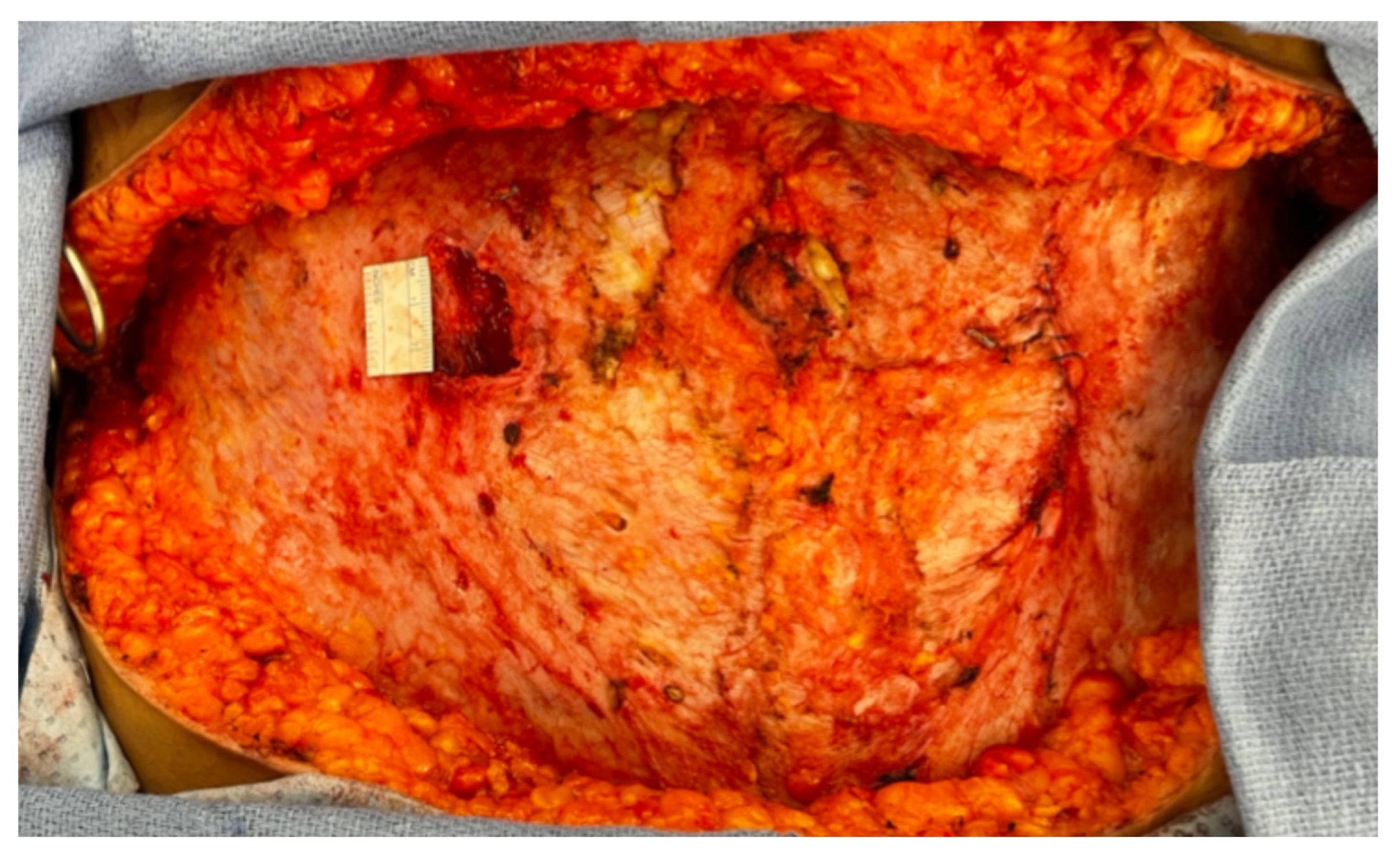 Preprints 170323 g004