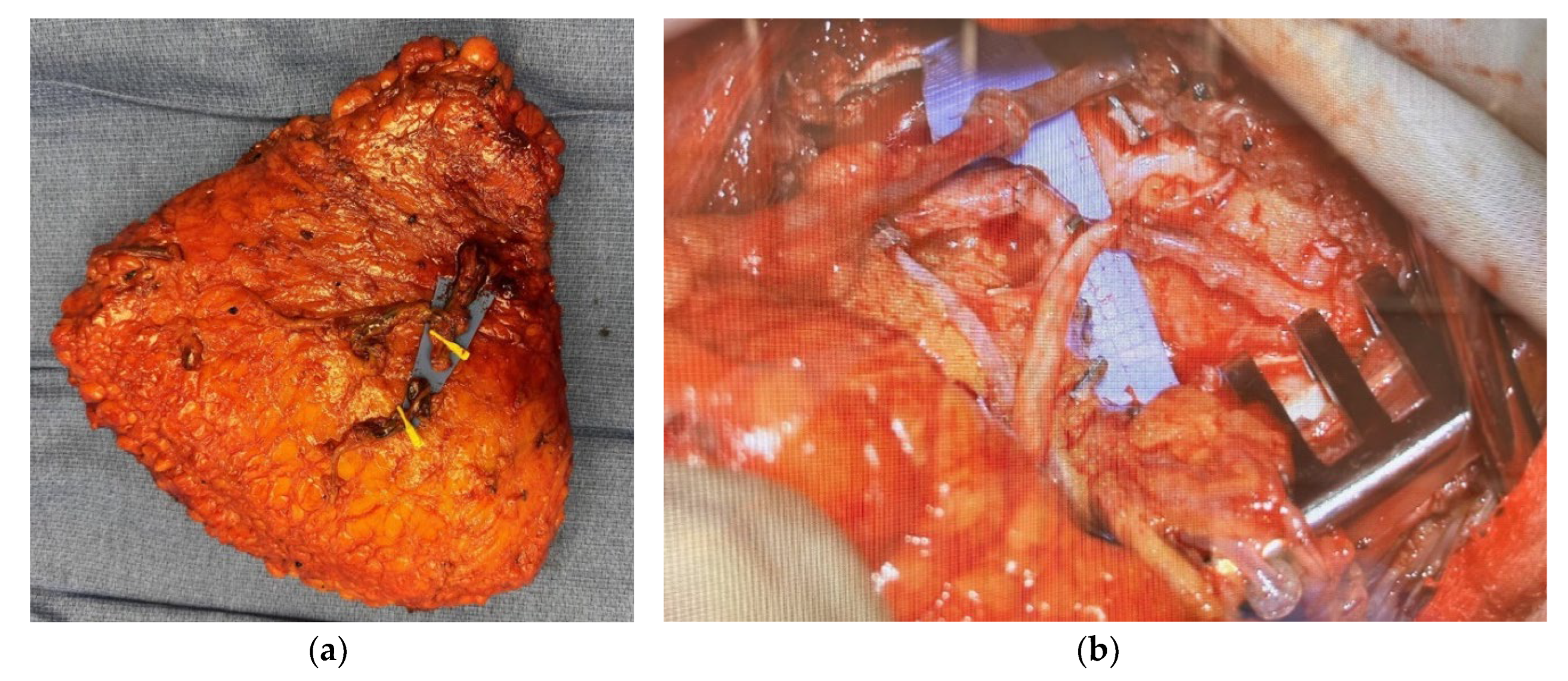 Preprints 170323 g005