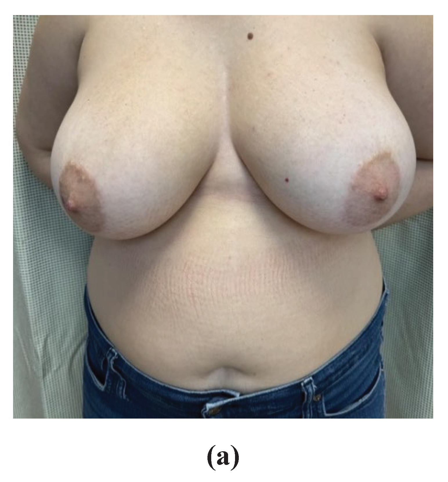 Preprints 170323 g006a