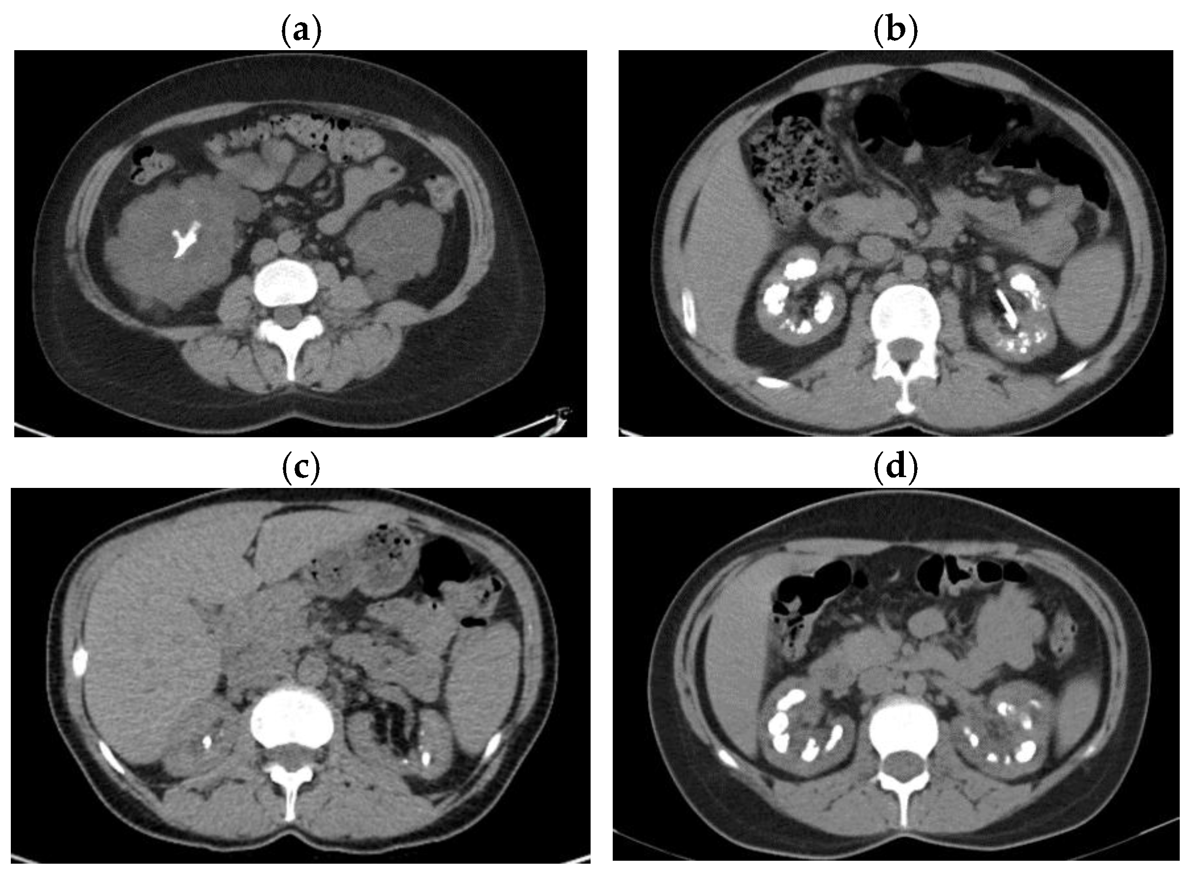 Preprints 153146 g003