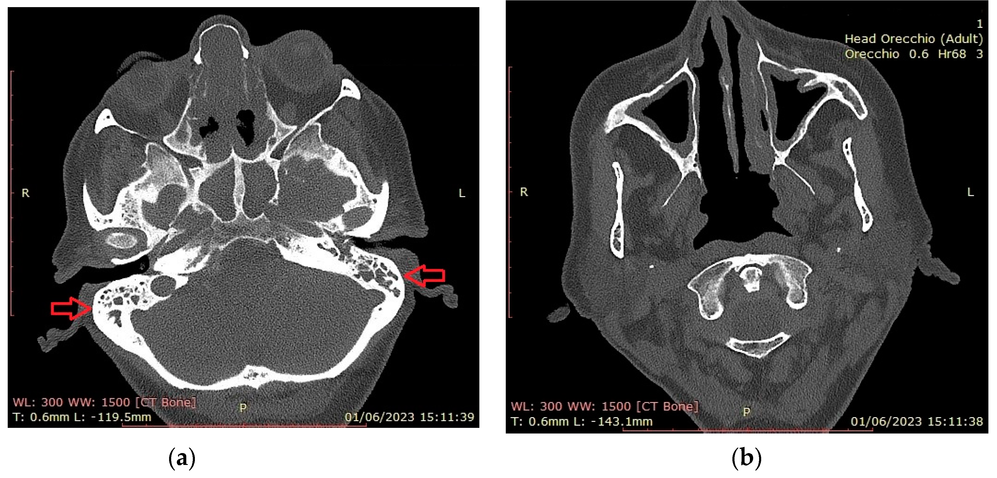 Preprints 85266 g002