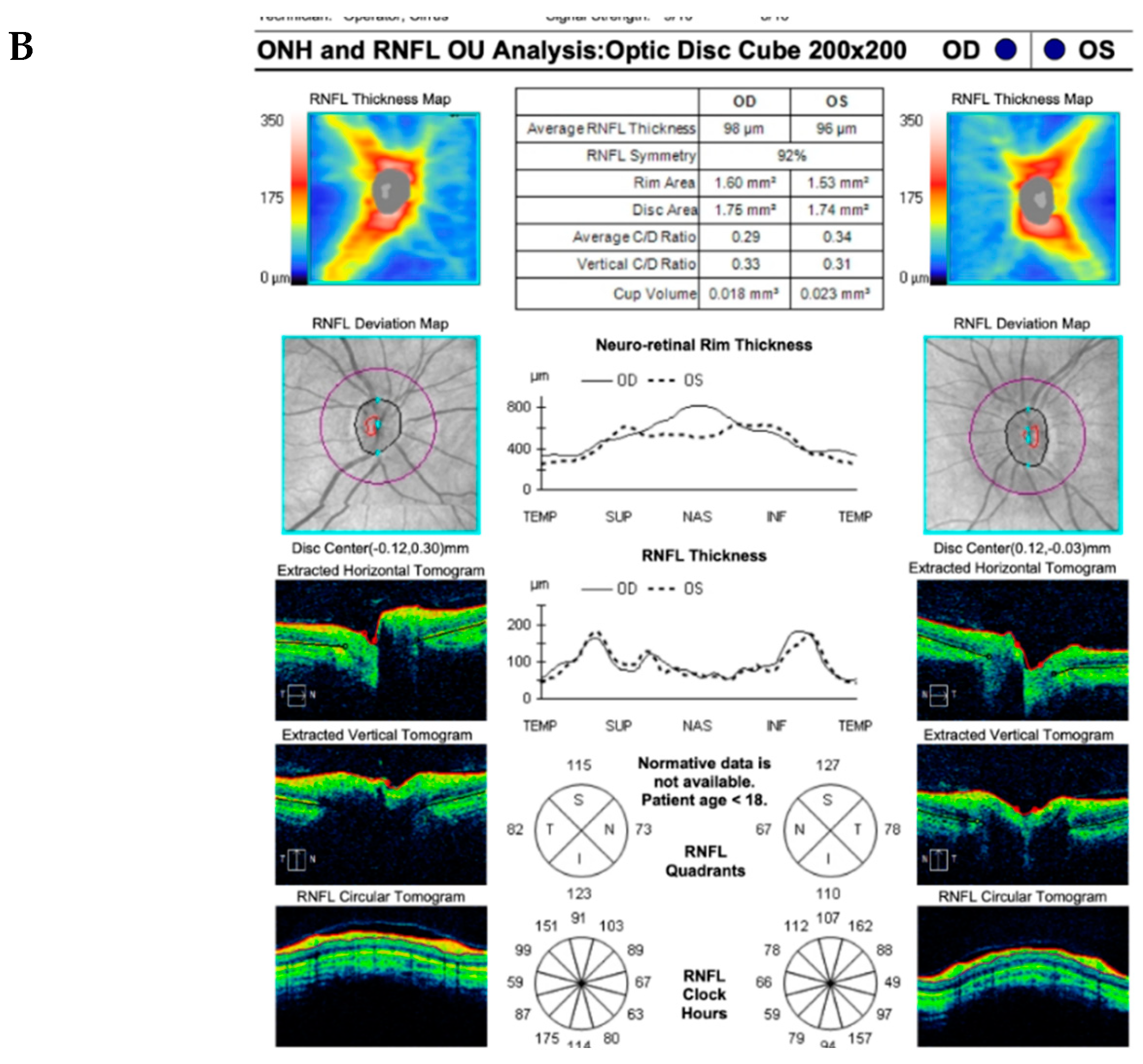 Preprints 97213 g008b