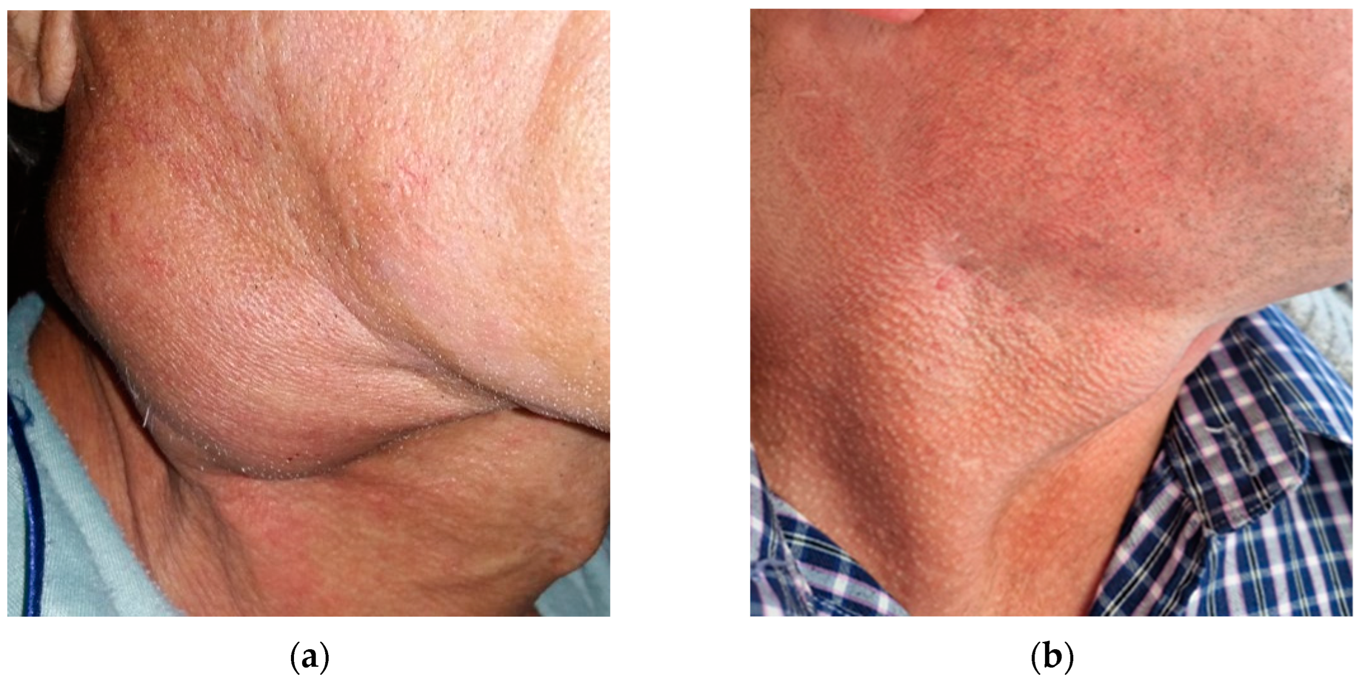 Preprints 155764 g002