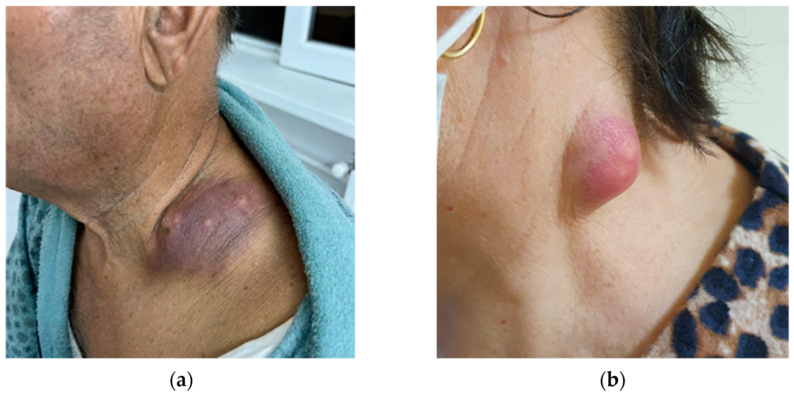 Preprints 155764 g004