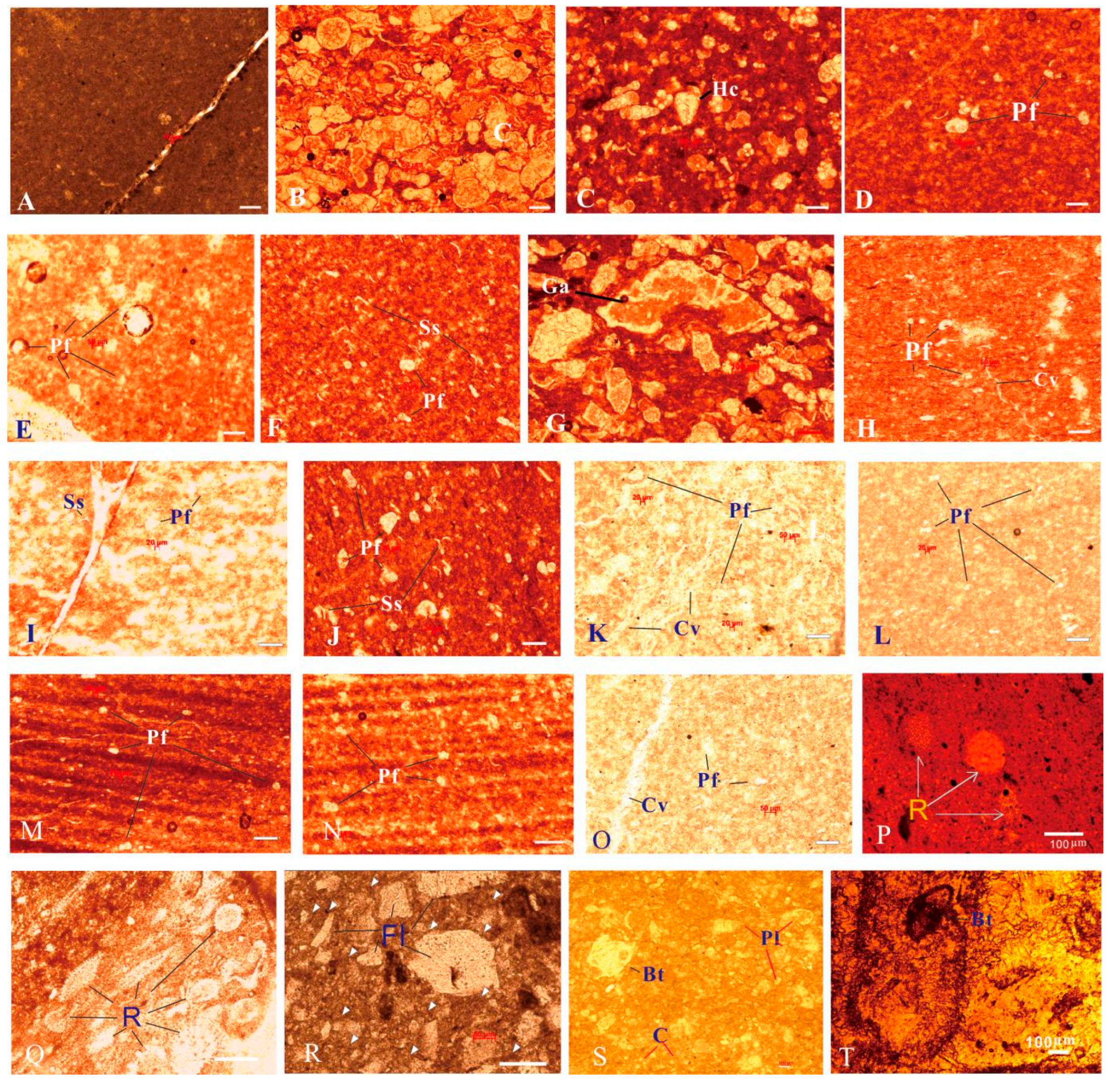 Preprints 156247 g011