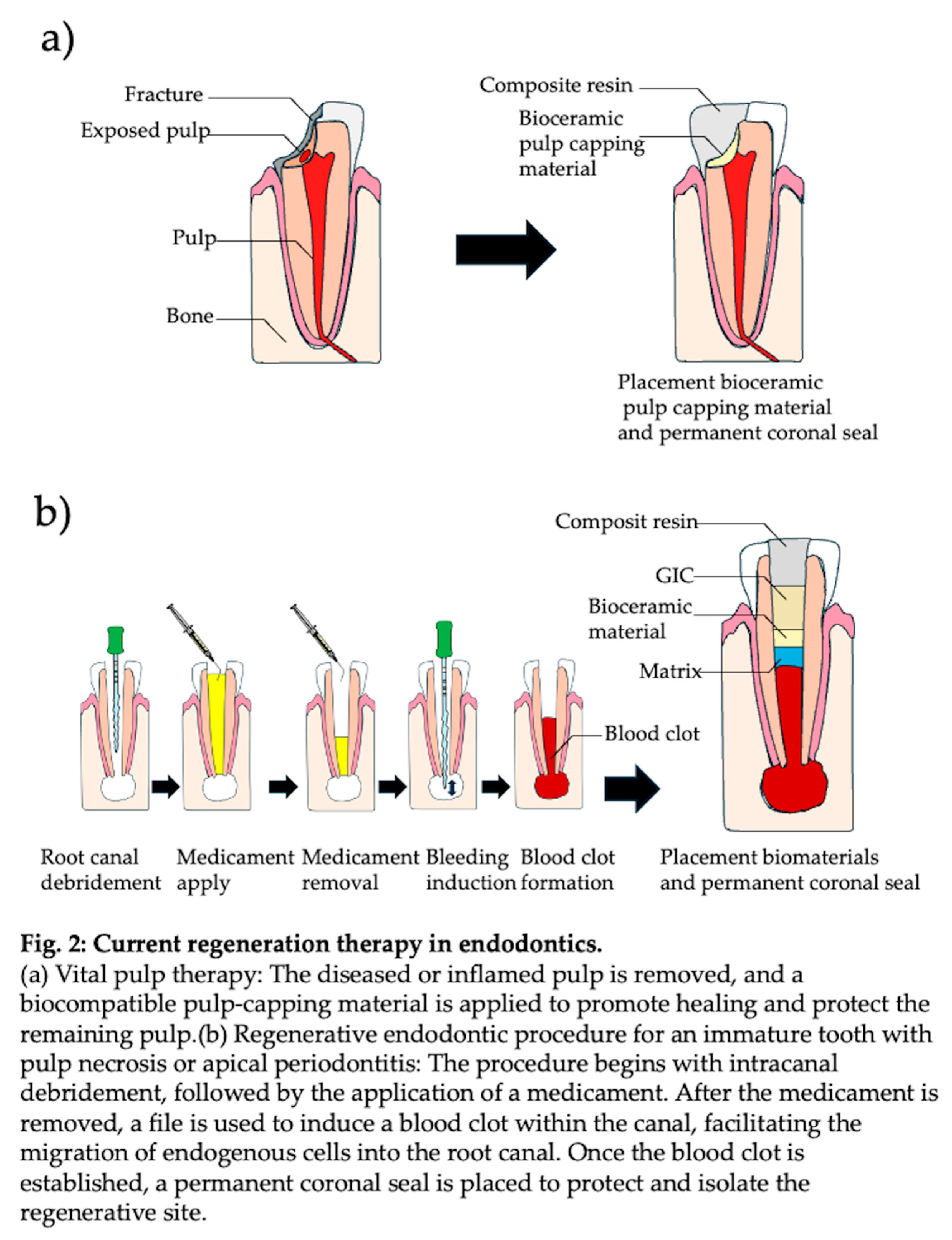 Preprints 148323 i002