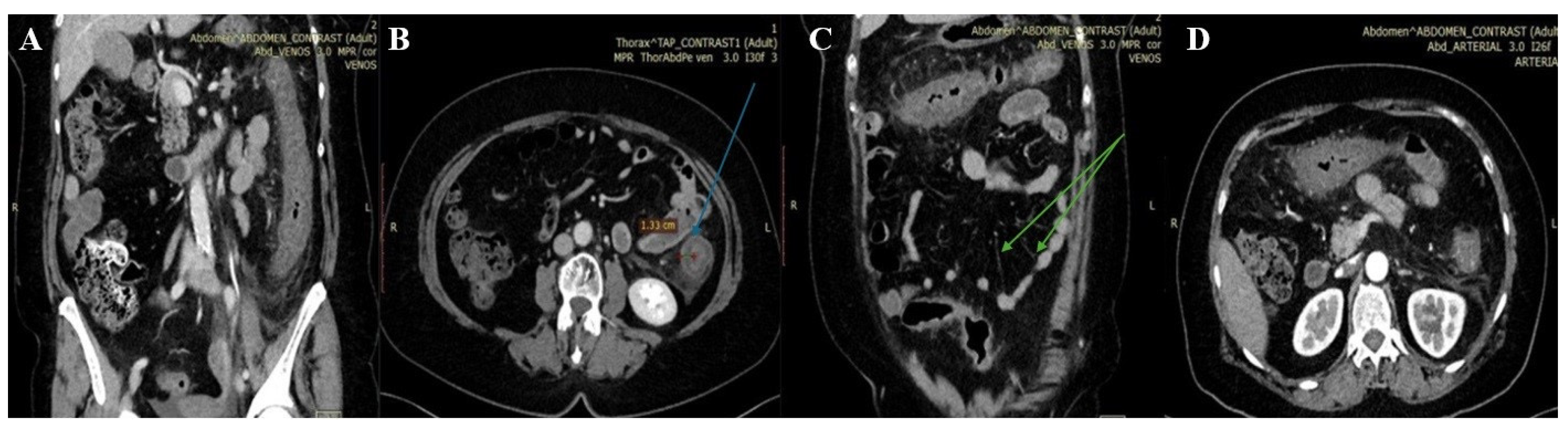 Preprints 98379 g001