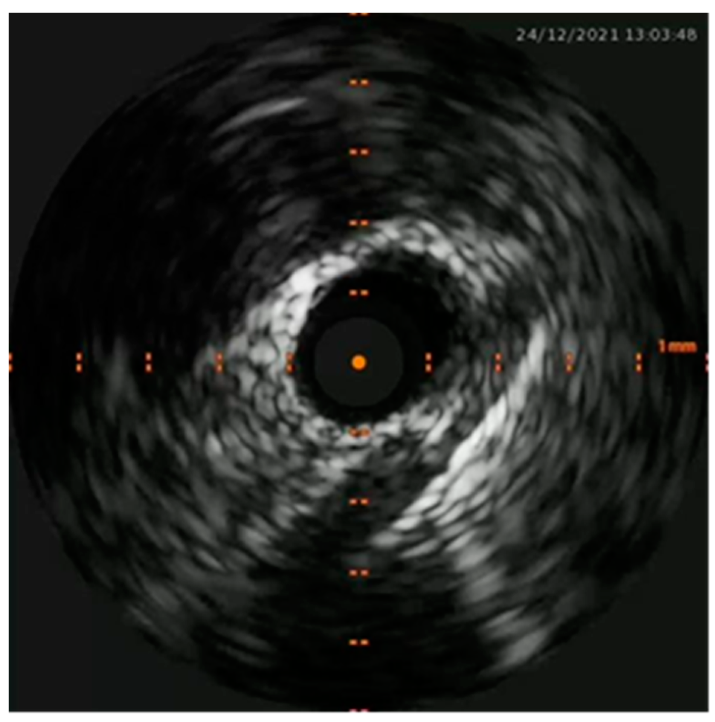 Preprints 76841 g006