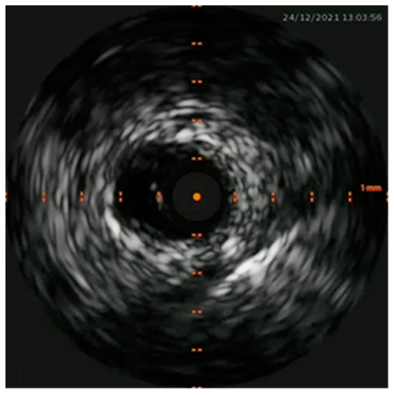 Preprints 76841 g007