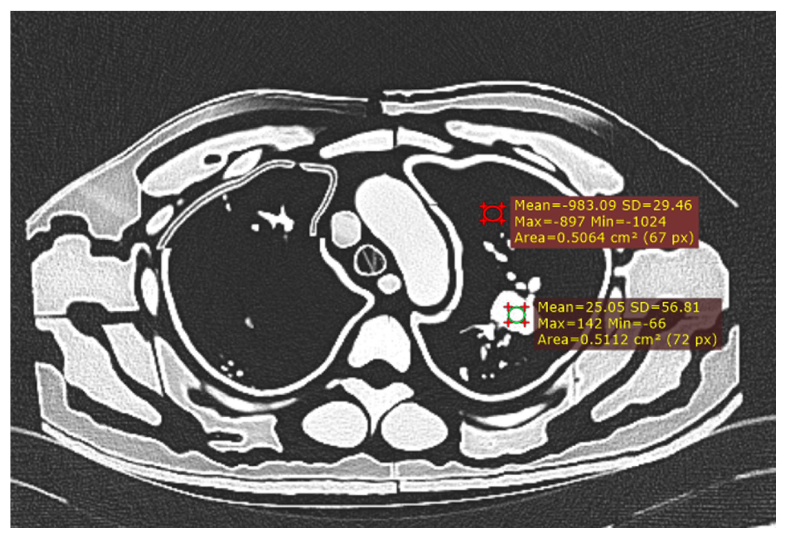 Preprints 139782 g003