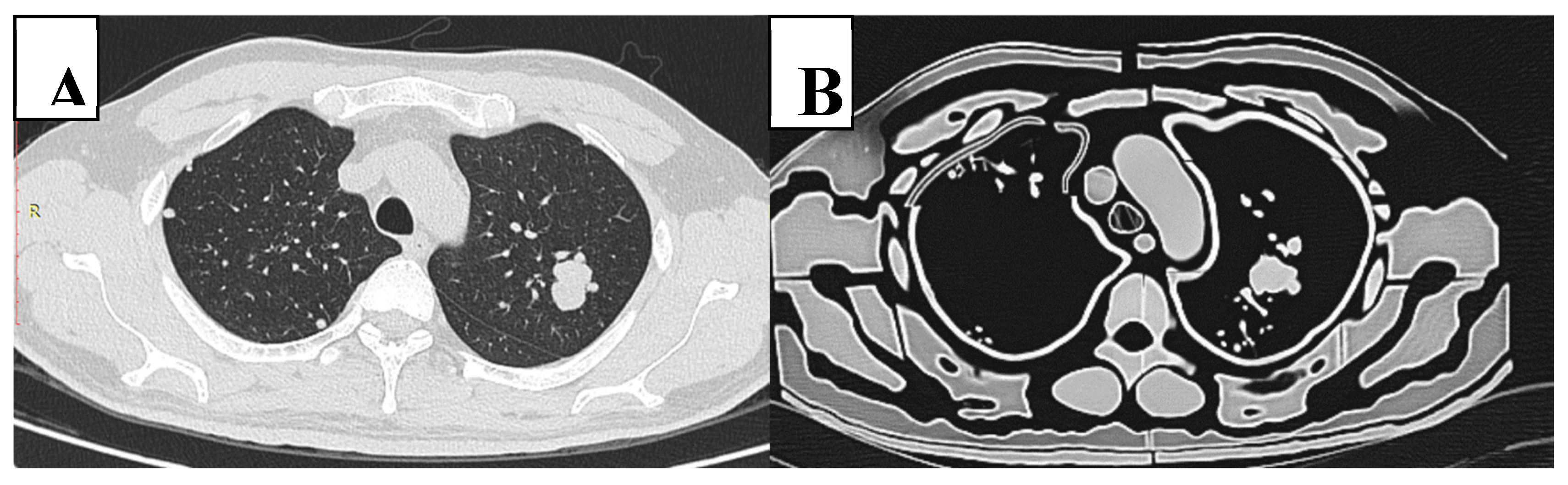 Preprints 139782 g006